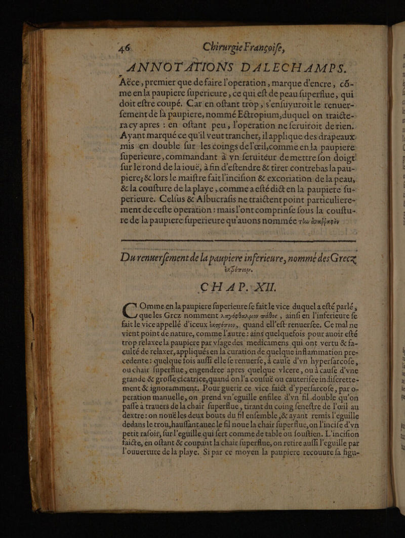Aëce, premier quedefaire l'opération, marque d'encre, cô-: mé en la paupiere fuperieure , ce qui eft de peau fuperflue, qui doit eftre coupé. Car en oftant trop; s'enfuyuroitle renuer- fement de là paupiere, nommé E&amp;tropium,duquel on traiéte-- racy apres : En oftant peu, l'operation nefeïuiroit derien. Ayant marqué ce qu'il veut trancher, ilappliquedes drapeaux mis «en double fur les coings de l'œil;comme en la paupiere: fuperieure, commandant à vn feruitéur demettre fon doigt! fur le rond de la iouë, à fin d'eftendre &amp; tirer contrebas la pau- piere; &amp; lors le maiftre fait l'incifion &amp; excoriation dela peau, &amp; la coufture de la playe ,commeaeftédiét en la paupiere fu perieure. Cellus &amp; Albucrafis ne traiétent point particuliere- ment de cefte operation : maisl'ontcomprinfe fous la couftu- re de la paupiere fuperieure qu'auons nommée rlu évepiaghy Rares pe] Durenuer[ement de la paupiere inferieure, nomme desGrecz txNériop, CH 4 P. XII. Omimeen lapaupiere fuperieure fe fait le vice duquel a efté parlé queles Grcz nomment xæydplaamar atlos , ainfi en l’inferieure fe fait le viceappellé d’iceux &amp;wér10,, quand elleft-renuerfée, Ce mal ne vient point de nature, comme l’autre: ains quelquefois pour auoir efté trop relaxeela paupiere par vfagedes medicamens qui ont vertu &amp; fa- culté de relaxer, appliqués en la curation de quelque inflammation pre- cedente: quelque fois auffi elle fe renuerfe, à caufe d’vn hyperfarcofe, ouchair fuperflue, engendrec apres RSR vlcere , ou à caufe d'vne grande &amp; grofle cicatrice,quand on l'a coufué ou cauterifee indifcrette: ment &amp; ignoramment, Pour puerir ce vice faict d'yperfarcofe, par o- peration manuelle, on prend vn'eguille enfilee d'vn fl.double qu’on pañle a trauers de la chair fuperflue, tirant du coing feneftre de l'œil au dextre: on nouë les deux bouts du fil enfemble ,&amp; ayant remis l’eguille dedans letrou,hauflantauec le fil noue la chair fuperflue, on l'incife d’vn etit rafoir, furl'eguille qui fert comme de table ou fouftien. L'incifion Eiéte en oftant &amp; coupant la chair fuperflue, on retire auffi l'eguille par l'ouuertute dela playe, Si par ce moyen la paupiere recouure fa fieu-