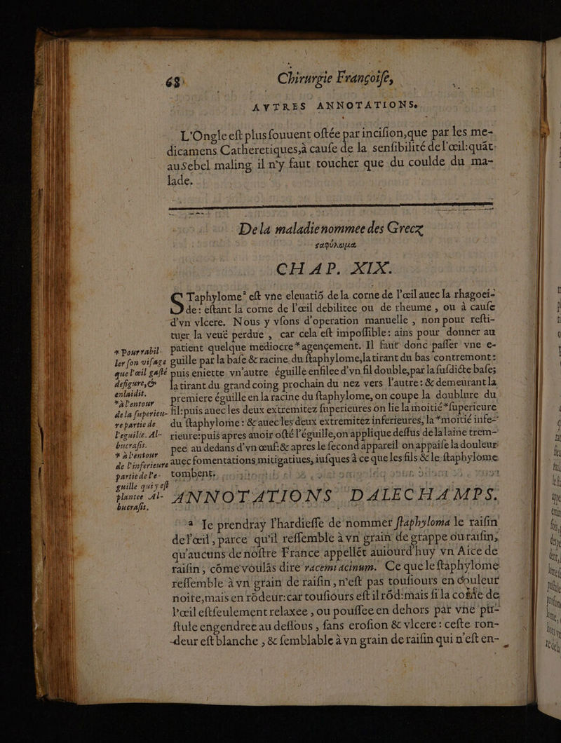 AYTRES ANNOTATIONSe. L'Ongleeft plusfouuent oftée par incifion,que par les me- dicamens Catheretiques.à caufe de la senfibilité del'œil:quât, ausebel maling il n'y faut toucher que du coulde du ma- fade. CH AP. XKIX: S Taphylome® eft vne eleuatiô dela corne de l'œil auec la rhagoeï- de: eftant la corne de l'œil debilitee ou de rheume , ou à caufe d'yn vlcere. Nous y vfons d’operation manuelle ; non pour refti- tuer la veuê perdue , car cela eft impoffible: ains pour donner au x pourrabil. Patient quelque médiocre” agençement. Il faut donc pañler vne e- ler fon vifage guille par la bafe &amp; racine.du ftaphylome;la tirant du bas contremont: que l'œil gaflé puis eniette vn'autre éguillé enfilee d’yn fil double, par la fufdiéte bafe; defigure,&amp; litirant du grand coing prochain du nez vers l’autre : &amp; demeurant la laidit. à , ss ne our Premiere éguille en la racine du ftaphylome, on coupe la doublure du dela fuperieu- Al:puis auec les deux extremitez fuperieures on lie la moitié *fuperieure repartiede du ftaphylome : &amp;auecles deux extremitez inferieurés, la “moitié infe=' l'eguille. Al- rieure:puis apres auoir ofté l'éguille,on applique deffus dela laine trem- RS A pee audedans d'vn œuf.&amp; apres Le fecond appareil on appaife la douleur de l'inferieure EC fomentations mitigatiues, iufques à ce que Les fils &amp; le faphylome partedere. COMbENEE monoutil els ylétoatenldq Jour don 55 « ru guille qui y ef | SA dues | plantee Al- ANNOTATIONS D ALEC H A MP a bucrafis, Hi a Je prendray l'hardieffe de nommer flaphyloma le raifin delæil, parce qu'il reffemble à vn grain de grappe ouraïfin, qu'aucuns de noftre France appellét auiourd huy vn Aice de raifin, comevoulâs diré racemiacinum. Ce queleftaphylome reffemble à vn grain de raifin ,n'eft pas toufiours en Couleur ftule engendree au deflous , fans erofion &amp; vilcere: cefte ron-