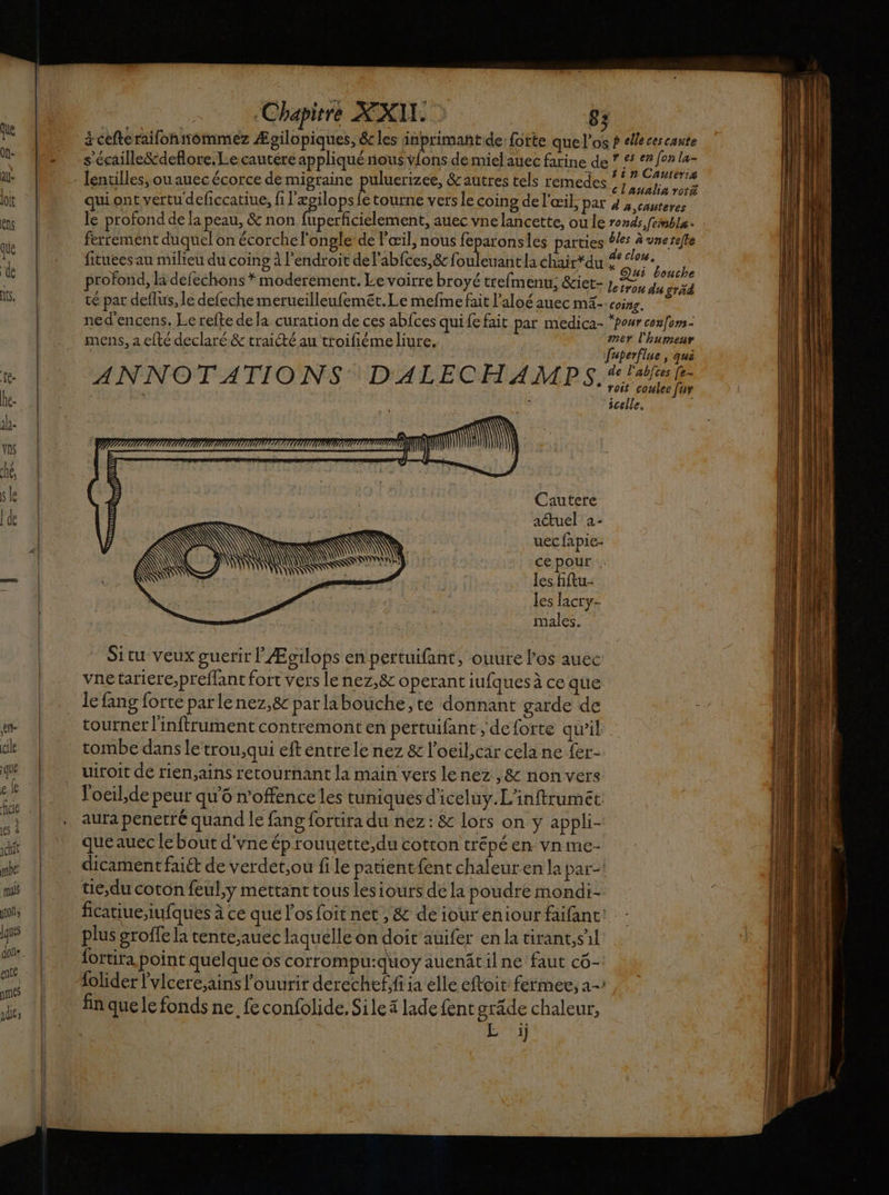 en ile : que e {e rs À ichit mbe mis jtoïls Jque don ee amies dés Chap XXI 2 8; 3 cefte raifoñ ommez Ægilopiques, êc les inprimant de: fotte que l'os ? elle ces caute s'écaille&amp;deflore.L.e cautére appliqué nous vfons de miel auec farine de * £* °2 fer la- : + ten Cauteris à OR EE ! Fr cl'analiarori qui ont vertu deficcatiue, fi l'ægilops fe tourne vers le coing de l'œil, par 4 4 cauteres le profond de la peau, &amp; non fuperficielement, auec vne lancette, ou le ronds, femble. ferrement duquel on écorche l’ongle de l'œil, nous feparonsles parties 4/5 à vnetefte ] B P fituees au milieu du coing à l'endroit de l'abfces,&amp; fouleuantla chair du #” clos, Qui bouche rofond, li defechons * moderement. Le voirre broyé trefmenu; &amp;iet-1,#, du gräd té par deflus, le defeche merueilleufemét. Le mefme fait l’aloé auec mA coing. ned'encens. Le refte de la curation de ces abfces quife fait par medica- “pour cou[oms- mens, a efté declaré &amp; traicté au ttoifiémeliure. mer l'humenr : faperflue, qui ANNOTATIONS DALECHAMPS, A 5 ; w FE icelle. Ki Cautere actuel à- uec fapie- cepour . les fftu- les lacry- males. SONT LU ln) U À NS \N Ÿ Situ veux guerir l Æotlops en pertuifant, ouure l'os auec vne tariere,preffant fort vers le nez,8&amp; operant iufques à ce que le fang forte parle nez,&amp;c parlabouche,te donnant garde de tourner l'inftrument contremont en pertuifant , de forte qu’il tombe dans le trou,qui eft éntrele nez &amp; l'oeil,car cela ne fer- uiroit de rien,ains retournant la main vers lenez ,&amp; non vers Voeïl,de peur qu'6 n’offence les tuniques d'iceluy.L'inftrumét. aura penetré quand le fang fortira du nez: &amp; lors on y appli- queauec le bout d'vne ép rouuette,du cotton trépé en vnme- dicament fait de verdet,ou fi le patentfent chaleur en la par: tie,du coton feul,y mettant tous lesiours de la poudre mondi- ficatiue,iufques à ce que l'os foit net ; &amp; de ioureniour faifant: : plus groffe la tente,auec laquelle on doit auifer en la tirant,sl fortira point quelque Ôs corrompu:quoy auenitilne faut cô- fin que le fonds ne, fe confolide. Sile # lade fent grâde chaleur, E à)
