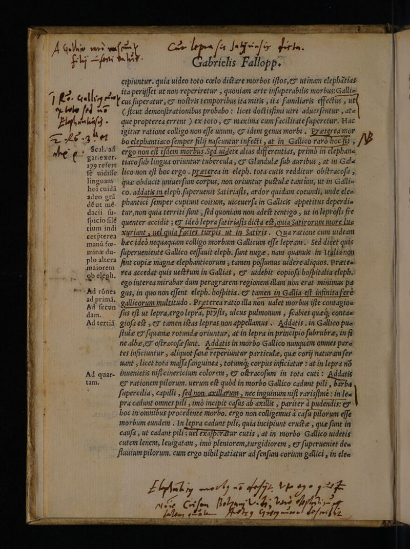 mam EI Fh rs rielis Fallopp. eipiuntur. quia uideo toto clo distare morbos iftos, utinam elepbatias ^ g2 T i : ita perüffet ut non reperiretur , quoniam arte infuperabilis morbus: Galliz: l E 2g P eus fuperatur, e nostris temporibus ita itis , ita familiaris effectus , ut ey ile 7 I ( ficut demonfirationibus probabo :. licet dodtisfi imi uiri aduerfentur , ate [2 JA aha d . que propterea errent ) ex toto , €9' maxima cum facilitate f uperetur. Hac M Le 4 e igitur ratione colligo non effe unum, e2' idem genus morbi , preterea &amp;. JV EB ot. bo elephantiaco femper filij nafcuntur infecti , at in. Gallico raro boc ftt E e i Scal/al eroo non eff ifdem morbus Sed uigete alias differentias, primà in c T al jn proni tiacofub lingua oriuntur untur tubercula , e Glandule fab auribus , at in Gala fé uidiffe- lico non efl boc ergo . preterea in. eleph. tota cutis redditur obstracof. i5 linguam que obducit uniuerf: um corpus, non oriuntur pustule tantum ut in Galli i hoi cuidi co. addatis in elepb.fuperuenit Satiriafls, ardor quidam coeundi, unde elec : d opened déut 5 phantici femper cupiunt coitum, uiceuerfa in Gallicis appetitus deperdis dacii fu- £ur,nom quia territi funt , fed quoniam non adest tentigo , ut in leprofis qs e fpicio file quenter accidit ; c2 ideo lepra fatiriafis dicla 4 est,quia Satirorum more tium indi cetpterea xyriant. uel quia facies turpis ut in Satiris. OQ uaratione cum dba manüfe- Pec ideo nequaquam colligo morbum Gallicum efJe lepram. sed dicet quis min du- füperueniente Gallico cefJautt eleph. funt nugae . nant quanuls in Ttalid non ploaltera frt copig maone elephanticorum ; tamen po[Jumus uiderealiquos. Pretes: maiorem ^*. ; : M v ridi enn obeleph, ^4 &amp;ccedat quis uestfum in Gallias , e*- uidebit: copiofabofbitalia elepb.: ^ '* egointercamirabar dum peragrarem regionem. illam non erat- minimus p4 ^ Ad rónes. gus, in quo ron effent. eleph. bofbitia. e» tamen amen in Gallia eft infinita fere PURUS gallicorum multitudo . Preterea ratto illa non on ualet morbus ifle contagios dam. . f^s efe ut lepra;ergo lepra, ptyfis, ulcus pulmonum ; fcabies qued; contae Adtertiá. giofaest , ex tamenislas lepras non appellamus . Addatis. in Gallico pue ftile e fquame votunide oriuntur, at in lepra ín priticipio fubrubre; in fü ne albe 3 oftracofe funt. Addatis in morbo Gallico nunquam omnes pare tes inficiuntur , aliquot fae repe reperiuntur particule, que corij naturam fer Want licet £ota ma|Ja fanguinea , totumd; corpus inficiatur : * at in lepra rio Ad quar- Üitenietis tfi cinericium colorem , eo oseracofum in tota cuti: Addatis tam. e? rationem pilorum. uerum est quod in morbo Gallico cadmnt pili , barba fpercilia , capilli , fed uon axillarum , , tiec inguinum nifi T rarisftme : in e| Jt —— marcii -- TY —— som uei CRM See i oh paene HR pra cadunt omnes pili imo incipit cafüs ab axillis , pariter t pudendis: es boc in omnibus procedente morbo. ergo non n colligemus à 4 cafa pilorum effe morbum eundem . In lepra cadunt pili, quia incipiunt crusbe , que funt in caufa ut cadant pilis ueTexa]peratur cutis , at in morbo Gallico uidetis cutem lenem, leutgatam , imo plemtorem,turgidiorem , ez fuperueniet des (m |o fluuium pilorum. cum ergo uiil patiatur ad fenfum corium gallici , in clee H | bn ^ 2, d. [m o EA