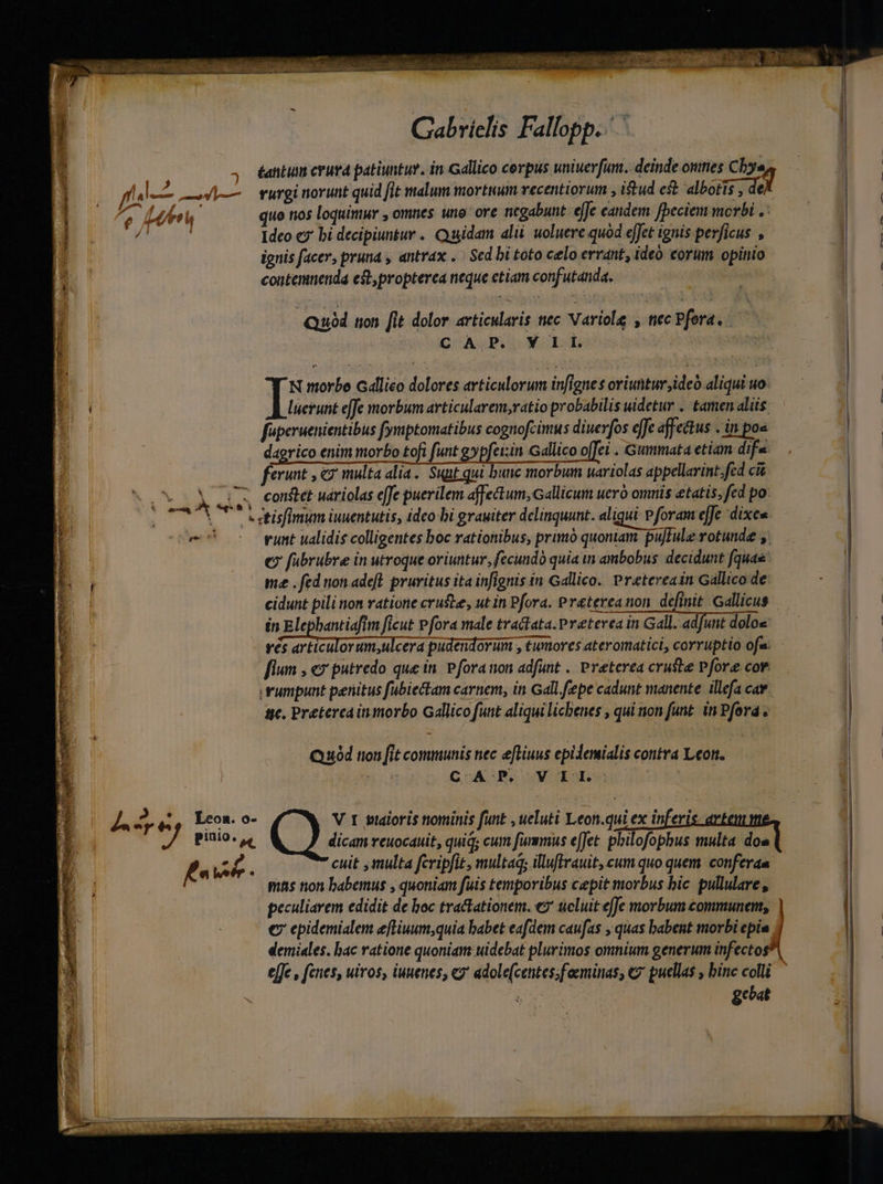 MERE Er Ree ree celo LP € Gabrielis Fallopp.. b , éantum eruta patiuntur. in Gallico corpus wniuerfum. deinde onmes Cra é E : a nee fa — —— — rurgi norunt quid fit malum mortuum recentiorum , iud est albotis , 29 7 718 quo nos loquimur , omnes uno ore ntgabunt effe candem fpeciem morbi .: Idco c? bi decipiuntur .. Quidam alii. uoluere quod efJet ignis perficus , ignis facer, pruna , antrax . | Sed bi toto celo errant, ideó. corum opinio contemnenda est propterea neque etiam confutanda. | DOT nas dali eue Tn Quid non [it dolor articularis tec Nariole , nec Pfora. C AP. Y LT. Y N morbe Gallico dolores articulorum infignes oriuntur ideo aliqui uo | luerunt ejfe morbum articularem,ratio probabilis uidetur .. tamen aliis j fuperuenientibus fymptomatibus cognofcimus diuevfos efe affectus . in po« dagrico enim morbo £ofi funt gypfeiin Gallico o[ei . Gummata etiam dife ferunt , &amp; multa alia. Sqat qui bunc morbum uariolas appellarint. fed cit V X ru conset uariolas effe puerilem affectum,Gallicum uero omnis etatis, fed po: V SU T etisfimum iuuentutis, ideo bi grauiter delinquunt. aliqui Pforam effe dixee 3 o yunt ualidis colligentes boc rationibus, primó quoniam pufIule rotunde ;. € fübrubre in utroque oriuntur, fecundà quia in ambobus. decidunt (quas fium , «x putredo que in. Pforanon adfunt .. Preterea cruste Pfore cor rumpunt penitus fubiectam carnem, in Gall.fepe cadunt manente illefa cay sc. Pretercainmorbo Gallico funt aliqui licbenes , qui non funt. in Pford , domu dea Cc PEE Ee lec in dila aene et Le E tri t— is] Ez | :- e e-— 2 Ej | x Cs 2 o m *- E e— € C — &amp; ES A t i» 2 m ia] t b-] - ba &amp; e. E ^ ES E Hi EST £i. E $ vd £e o q— [ ^ Quod non [it communis nec eftiuus epidemidis contra Leon. depen, Lco. o- | Vor gualoris nominis funt , ueluti Leon.qui ex inferi J pino. ue dicam reuocauit, quiq; cum fummus effet philofopbus multa doe fub. cuit ,multa fcripfit, multaq; illuflrauit, cum quo quem. conferaa mas non babemus , quoniam fuis temporibus cepit morbus bic pullulare , peculiarem edidit de boc tractationem. €5' tieluit effe morbum communem, | €7 epidemialem efliuum;quia babet eafdem caufas , quas babent morbi epi J demiales. bac ratione quoniam wuidebat plurimos omnium generum infectogA effe , fenes, uiros, iuuenes, «2' adole(centes;foeminas, € puellas , binc colli gebat C —