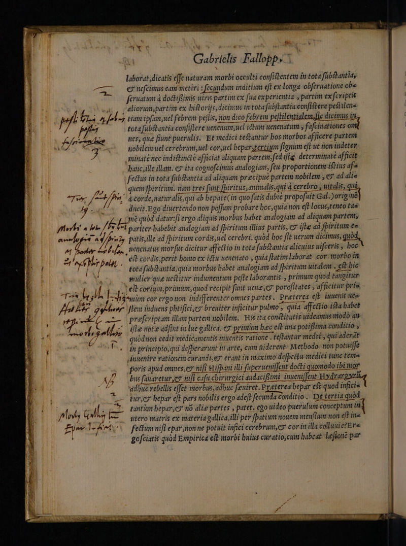brio tc ÉRSENRBADM Sp Rf Se ilo | Gabrielis .Fallopp. *.  N laborat dicatis effe naturam morbi occulti confitentem in tota fübstantia, CL €eeimus eam metiri : ecundum inditium eft ex longa obferuatione ob« | feruatum à doctifgimis utris partim ex fua experientia: ; partim ex fcriptis | a, , ; eliorum;partim ex bistorijs, dicimus tn tota fabflantia confistere pestilene LAUNE pf 7d Af lon tiam ipfam,uel febrem petis, non dico febrem pefBilentialen, fie dicimus in | pf tota fubftantia confiflere wenenum;ucl itum wenenatum , fafcitationes omi Jefe nes, que fiunt puevulis. Et medici testantur bos morbos afficere partem m dini sterilitas 2 ERN E à [3 nobilem uel cerebrum, uel coryucl beparstertuum fignum eft ut non indeter aminate nec inditindte afficiat aliquam partem.fed ifIg determinate afficit baiic, ille illam. e ita cognofcinus analogiam, feu proportionem istius afe fettus in tota fübstantia ad aliquam precipue partem nobilem , 7 ad alie jM 70, &amp;. , due piritum. nam tres funt fpiritus; animalis,qui à cerebro , uitalis, qui ^75, iin á-corde, naturalis, qui ab bepate(in quo fatis dubie propofuit Gal.)originé j4 AME ducit.Ego ditiertendo non pofJum probare hoc, quia non eft locus,teneo tas y Ls quód datur:[i ergo aliquis morbus babet analogiam ad aliquam partem; meri ^ boi. /. ^? ^l pariter babebit analogiam ad fpiritum illius partis, c? ifle ad fpiritum ec | aeedugei ^ 1n pátis,ille ad fbiritum cordis,uel cerebri. quod boc fit uerum dicimus, quod ^ oer e Lu etienatus morus dicitur affectio in tota fubstantia alicuius uifceris ; hoc 2j! Nd Mr m c cordis; perit boitio ex ictu ueuettato , quia fiatim laborat. cor morbo tf [1 £ot4 fabstantia, quia morbus babet analogiam ad fpiritum uitalem . est bic pudier que uestitur indumentum pefte laborantis , primum quod tangitur du » J [ [- 12 (i5 1 dieit i Asi fuit dese porofitates , afficitur A - ue a coat cor ergo non indifferenter omnes partes. Preterea eL uenis uee Ia Enn gg [iem induens phtificisey breuiter inficitur pulmo , quia affcttio ista babet C LI o preferiptam ülam partem nobilem. Bis ita constitutis uideamus modo at V ' dfle noté adfint in lue gallica. e» primm bec est una potiffima conditio , 7 quodin cedit medicamentis inuentis vatione . tefantur medei , qui aderat '. dn principioqui defberarunt in arte, cum niderent: M etbodo. non potuiffe inuenire vationeia curandi ex erant in maximo defpettu medici tunc teme poris apud omnes ,ey' nift Bifpani illi feperueniffent docti quomodo ibi nov (A. — bus fanaretur er nifl cafu chirurgici audacifimi inueni ent Hodrargaite : js adbuc rebellis effet vorbus, adbuc feuiret. Preterea bepar e$t quod inficis ains bepar e[t pars nobilis ergo adeft fecunda conditio. De tertia quód ot Q ML. E tantum hepar, no alie partes , patet. ego uideo puerulum conceptum in ] qeu rou. fero matris ex materia gallica;illi per fpatium nonem menfium non eft ine fy IA c fetum nifl epar, nonne potuit infici cerebrum,cy cor in llla colluuie?Ers à; gofciatis quod Empirica ef morbi buius curattocunm babeat leftoné par ?