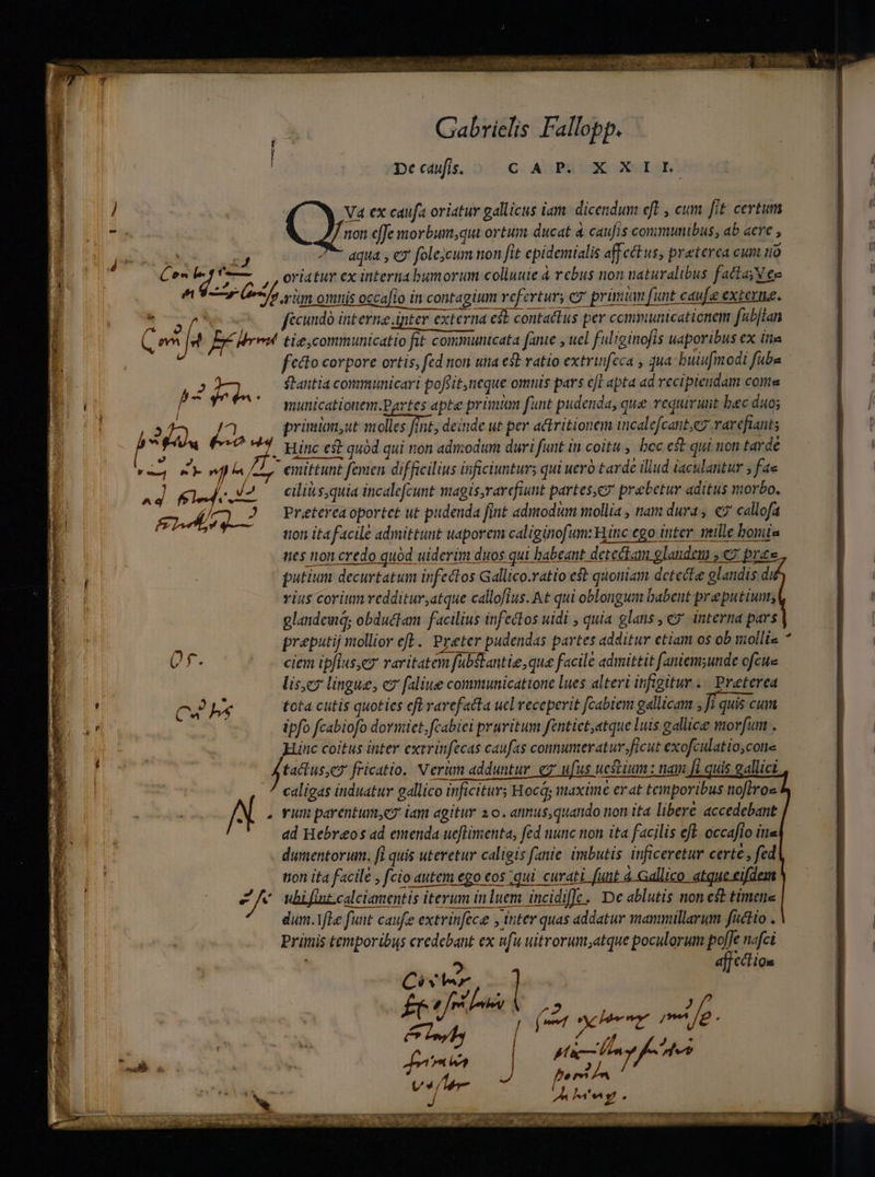 Gabrielis Fallopp. f | pe caufis. C. Av PH SE SB ! L V4 ex caufa oriatur gallicus iam. dicendum eft , cum fit certum ^ |^ non effe morbum;qui ortum ducat 4 caufis conimunibus, ab aere , d E d jy.xoss 2i ^P aqua , e? folecum non fit epidemialis aff ect us, preterca cum iio EL Cemlegfo— — oriatur ex internabumorium coliuuie à rebus non naturalibus fattasN €e | E «rv Gp rm omnis occafio in contagium refertur; ez primum funt caufe extern. A. ri , ib. fecundà interna pter externa eib contactus per communicationem fub[lan | u ovn (fa PX Mr tie,communicatio fit communicata fante y uel fuliginofis uaporibus ex itte NE feto corpore ortis, fed non uta est ratio extrinfeca , qua: buiufmodi fuba E dod ftantia communicari pofsit,neque omnis pars efl apta ad recipiendam come | | T '— municationem.Partes apte prünüm funt pudenda, que requirunt bec duo; óÓ6. -|/ E n /7] primum;ut molles fint, deinde ut per attritionem incalefcant,ez rarefiant; 8 (€ TT 7 Hinc est quód qui non admodum duri funt in coitu, bocest quinontarde —^— | — ' - » A e CE. gu : TE ' ' , r 5.5 - | ep OR ond Lu emittunt fenien difficilius itficiuntur; qui uero tarde illud (aculantur ; fae | ^. JJ cilia s,quia incalefcunt magis,rarcfiunt partes,cy prebetur aditus morbo. | * 2 Pretereaoportet ut pudenda fint admodum mollia , nam dura , «7 callofa tton itafacile admittunt uaporem caliginofum: Hinc ego inter. ntille boris nes non credo quód uiderim duos qui babeant detectam glandem ,€2 pre putium decurtatum infectos Gallico.ratio est quoniam detecte glandis:d Í vius corium redditur,atque callofius. t qui oblongum babeut preputiums glandeuq; obductam facilius infectos uidi , quia glans , €? interna pars | preputij mollior ef. Pyeter pudendas partes additur etiam os ob uiolliz E 4 L3 Qf. ciem ipfius, raritatem fubSlantie,que facile admittit faniem;unde ofcue lisez lingue, ev faliue communicatione lues alteri infigitur .. Preterea | ' C b tota cutis quoties efl rarefacta ucl receperit [cabiem gallicam , Ji quis cum |.  ipfo fcabiofo doviict, fcabiei pruritum fentict,atque luis gallice morfum . | ' nc coitus inter exrvinfecas caufas conumeratur.ficut exofculatioscone | | ! fectus fricatio. Verum adduntur. ez' ufus uestium : nam Ji quis gallict | | caligas induatur gallico inficitur; Hocá; maxime erat temporibus noftros A . vun parentumyco iam agitur 2o. annus,quando non ita libere accedebant ad Hebreos ad emenda ueflimenta, fed nunc non ita facilis ef. occaflo itta : dumentorum. fl quis uteretur caligis anie imbutis inficeretur certe , fed b. tion ita facile , fcio autem ego eos ;qui. curati i Gallic J ; e ubi fint calciamentis iterum in luem incidiffce,/ De ablutis non est timene dum. fle funt caufe extrinfece , inter quas addatur mammillarum fictio . | Primis temporibus credebant ex ufu uitrorum;atque poculorum poffe nafci | , 4 afjcction Cir | | Ep trm oo | ul («et nltra  Pág p : pfi limp fees : em 2 v4/ler pnt d n | | yONEETSTCTE ouo ne^. T Rp VA CR Sant EB Aot AP em 0 PM Rn rte Mme ed 2 ^ i* ——— — B t . vo PUE