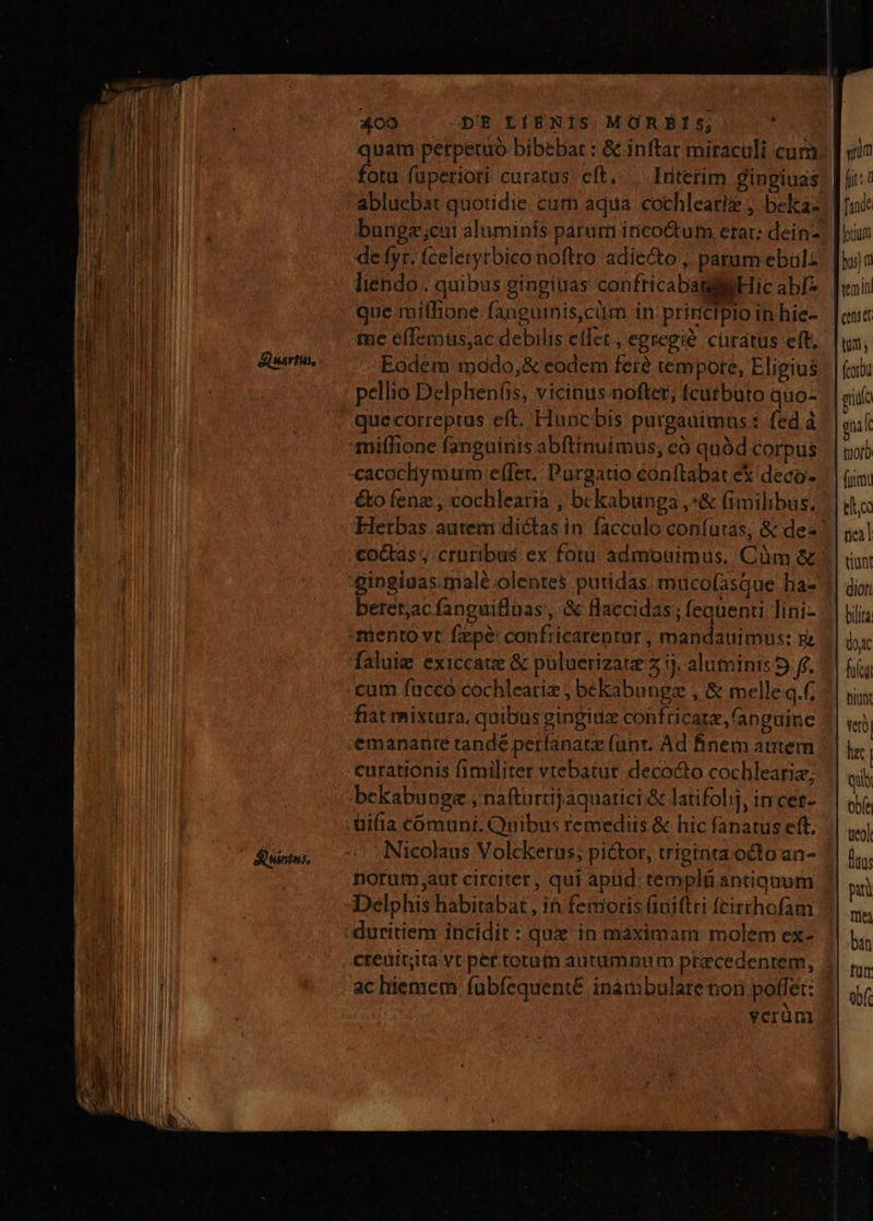 4co pB LtÍENIS MORBIS; ; quam petperuo bibebat : & inftar miraculi cum de fyr. fceletytbico noftro adiecto , param ebul: liendo . quibus gingiuas confricabatgll Hic abfz Que miffione fanguinis,cüm in priricipio in hie- me efIemus;ac debilis effet. egregie. cüraátus eft, Eodem modo,& eodem feré tempore, Eligius pellio Delphen(is, vicinus.nofter; fcutbuto quo- que correptus eft. Fluncbis purgauimas : fed à milione fanguinis abftinuimus, có quód corpus cacochy mum effer. Pargatio éonftabat eX deco: &o fenz , cochlearia , bekabunga ,*& fimilibus, co&tás ;.cruribus ex fotu admouimus, Cüm & 'gingiuas male olentes putidas. muco(asque ba- beret,ac fanguilluas', & Haccidas; fequenti lini- miento vt fepe: confricareptur, mandauimus: n faluig exiccaue & puluerizatz z 5j. aluminis 5 fr. cum fucco cochlearie , bekabungz , & melle q.f; fiat mixtura, quibus gingitiz confticarz fanguine emananté tandé perfanate (unt. Ad finem atttem curationis fimiliter vtebatut. decocto cochleariz; bekabungs ; nafturtrijaquatici & latifoli, in cet- üifia cómuni. Quibus remediis & hic fanatus eft. Nicolaus Volckerus; pi&tor, trietnta octo an- duritiem incidit : que in maximam molem ex- cteüit;ita vt per totum autümnum pracedenrem, ac hiemem fubfequenté inambulare nori poffet: ycrüm fuíci vero) hc) Qui obfe ueol ftu: pi üt bin für abf.