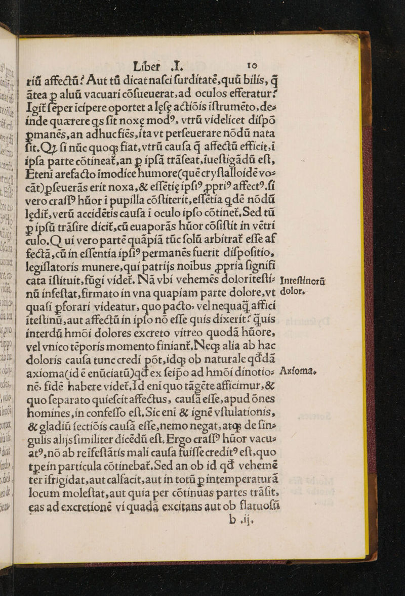 τᾶ affectü? Aut εὖ dícatnafa furditaté,quü bilis, q átea Ὁ aluü vacuari cofueuerat,ad oculos efferatur? Ioít (eper cipere oportet a Iefe actíoís iftrumeto, dez índe quarereqs fít noxe mod?. vtrü videlícet difpo manés,an adhucfíes,itavt petfeuerare nodü nata it.Qz fi πᾶς quog fíat,vtrü caufa d affect efficít.i ipfa parte cotíneat,an p íp(à tráfeatiueftioadü eft, Eteni arefacto imodíce humore(quecryflalloíde voz cát)pfeuerás erít noxa,& effétícípfi? ppri? affect?.fí vero cra? hüor i pupilla coftíterít,effetía qde nodá ledit, verü accídétis caufa i oculo ipfo cotinet,Sed τὰ p ἮΝ tráfire dícit,cü euaporás hüor cofiftít in vetri culo.Q uí veroparte quápíá tüc folü arbítrat effe af fectà ,cü ín effentía ipfi? permanes fuerit difpofitío, legiflatorís munere;quí patríjs noibus ,ppria fignifi quafí pforarí vídeatur, quo pacto vel nequad affici εἰ aut affectü in ipio no effe quís dixerít? quís ínterdü hmoí dolores excreto vítreo quoda hüore, vel vníco téporís momento finían£, Neg alía ab hac dolorís caufa tunc credí pot,idq; ob naturale qddà ne fíde habere vídet,.Id eniquo tágcteafficímur. & quo feparato quíefcícaffectus, caufa elfe,apud ones homínes,ín confeffo efl, Síceni δύ ígne vílulationis, & gladíü fectióís caufa efle)nemo negat; atop de fine gulis alijsfimiliter dícedá eft. Ergo crafi? hüor vacue at?,nó ab reifeflátis malí caufa tuiffecredit? eft, quo tpeín partícula cotínebat,Sed an ob íd qd veheme ter ifricidat;autcalfacit;aut ín totü píntemperaturà locum moleftat,aut quía per cótínuas partes tráfit, cas ad exctetíoné víquada excítans aut ob flatuofü b Ji,