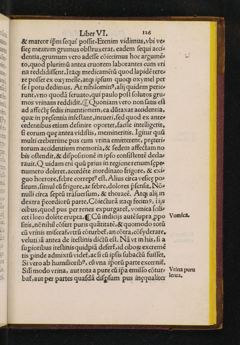 & matcot ípm fequi poffit-Etením vidímus,vbí ves fice meatum erumus obflruxerat; eadem fequí accía dentía,erumum vcro adeffe coíecímus hoc argume to,quod plurímü antea cruorem laborantes cum vrí na reddídiffent.Itag; medícametü quod lapídeterez re poffet ex oxymelle,atg ipfum quogp oxymel per runt,vno quodi feruato;quí paulo poft folutos στιν ad affecte fedis inuentionem, ea dütaxat accidentía, quz ín prefentía infeflant,intuerí,fed quod ex antes cedentibus etíam definire oportet,facile intelligetís, (i eorum queantea vídiflis, memínerítís. Igítur quà multí creberríme pus cum vrína emitterent, preterie torum accídentíum memoria, & fedem affectam no δίς oftendit, & difpofitione ín ipfo confiftente declaz rauít.C) uídam eni quü príus ín regíonerenumfepes numceto doleret;accedete ínordínato frigore, & exíe uo horrore;febre corrept? eft. Alíus círca vefice poe itum fimul cüfrigore;ac febre; dolores pfenfit, ING» nullí círca feptü trafuerfum, & thorace. Δίῳ alíj in dextra pcordíorü parte. Coiecturà τεῳ fecim?,; {5 oibus;quod pus per renes expurgaret, vomíca fcilie cetiloco dolete erupta. 41 Cü indicijs autefupra ppo fitís,nonihil cofert purís quátitate,& quomodo totü fupíoribus iteftínisquídpia defert.id cibos: excreme tis pinde admixtü videt;acfi cü ipfis fubactü fuiffet, Si vero ab humilíorib?, cü vna iporü parte excernit, Sil modo vrína. auttota a pure cü pa emiflo cotur: ba£,aut per partcs quafdá dífpfum pus ingqualiter Vomica,
