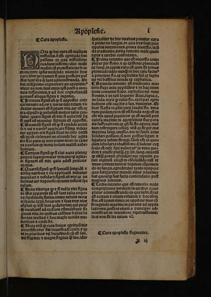 ¶ Cura apopleffe- O ta q hec cura eſt multum difficilis.ẽ em̃ egritudo bec Wl | peffuma ex qua difficilime Sl Zeuaduntinfirmi:ideo oicüt A medici cũ pꝛoteſtatione fe in raro liberari:tamen ſi qua proficere pof bet etiã pꝛimo cognoſcere an apopleticꝰ ¶ Dumum fignü eft ꝙ fi appofito coto carminato ad os ⁊ nares tale cotum vt) fi autẽ nó mouetur fignum eft oppoſiti. eſt. dz ti obſeruari ne aliunde bec agita ri ſignum eft vite quia adeft pectoꝛis immotus. ps 2 E 1 M ¶ Quartũ figni ꝙ ſi ſpeculũ limpidũ ⁊ terſuʒ naribus x oꝛi applicatũ videatur maculari ⁊ defedari:ſignũ eit vite qꝛ an helitus aer vapoꝛoſo exeunte inficiet ſpe culum. ¶ Hota olterius ꝙ ⁊ ſi nulla vite ſigna in iſtis appareãt tn nõ ſunt talia coꝛpo⸗ ra ſepelienda ſtatim immo debent moꝛa ri ſpacio.lxxij.hoꝛarum ⁊ ſunt tres dies cõpleti qꝛ viſi ſunt quãplurimi qui pꝛiuſ gnum vite. de quibus caſibus habes hi lieribus e coꝛde fri. vt in pluribus vel buiufmodi cá eft fan. vel flegma: ⁊ magisiflegma q; ſan.ideo à z pꝛimo de ſangui.in qua tres funt pꝛin cipales íntentiones.puma diuerſio.ſecũ da eradicatio.tertia remotio male quali tatis ⁊ cerebꝛi confoꝛtatio. ¶ P ꝛima intentio que eſt oiuerffo coms pletur per flobo.⁊ qꝛ exiſtente plenitudi ne ſang. in capiteraro cft quin ſit totíus plenitudo:ideo nunqᷓ; in boc cafu facim? a pꝛincipio flo.ex cepbalíca fed ex ſaphe na vel baſilica deinde ex cephalica. ¶ Secunda intentio eft eradicatio ma⸗ terie fluxe actu oppillãtis ⁊ in hac inten tione conuenit flobo. cephalice vel vene frontis.⁊ de tali loquens Auic.ſupꝛa.c. de ſoda.dixit ꝙ talis flo.extirpat egri⸗ tudines oẽs capitis a ſan.venientes. Et licet Raſis in pñti cura laudet ffo. vena rum guidem:non tii eſt fienda neq; eft in coi vfu apud pꝛacticos qꝛ cft multũ peri tis ſuffocationi:qꝛ qñ fit flo.opoꝛtʒ mul tum reſtringere colluʒ etiũ qꝛ fit per eas maxima ſang.emiſſio.nec oe facili con⸗ ſolidari poſſunt cũ non poſſint ligari ⁊ ligatura debite ſtringt. Nidi eff in quo» q nid potuit ↄſolidari nec reperiri po tuit ingeniũ aliqð in cõſolidãdo nifi vt vnus cotinue teneret digitum cõpꝛimen do ne ſangu.egrederetur tanto tempoꝛe quo fatigaretur:deinde alius aduenie⸗ bat quouſq; fuit facta conſolidatio poſt magnos laboꝛes. ¶ Tertia intentio que eſt remotio male complexionis derelicte in cerebꝛo com? pletur adminiſtrando ea que infri.ſicut eft acetum t oleum rofatum v hoc eſt in ſine.eſt tamen timoꝛ ne oppilent vías có ſtringendo maxime ín paratis ad oppilé lationes.poſſent etiam a piíncipio ad» miniſtrari in intentione repercuſſionis: ¶ Cura apopleſie ffegmatice. A i —  um — — - 2 Sent — o IUE 5 —