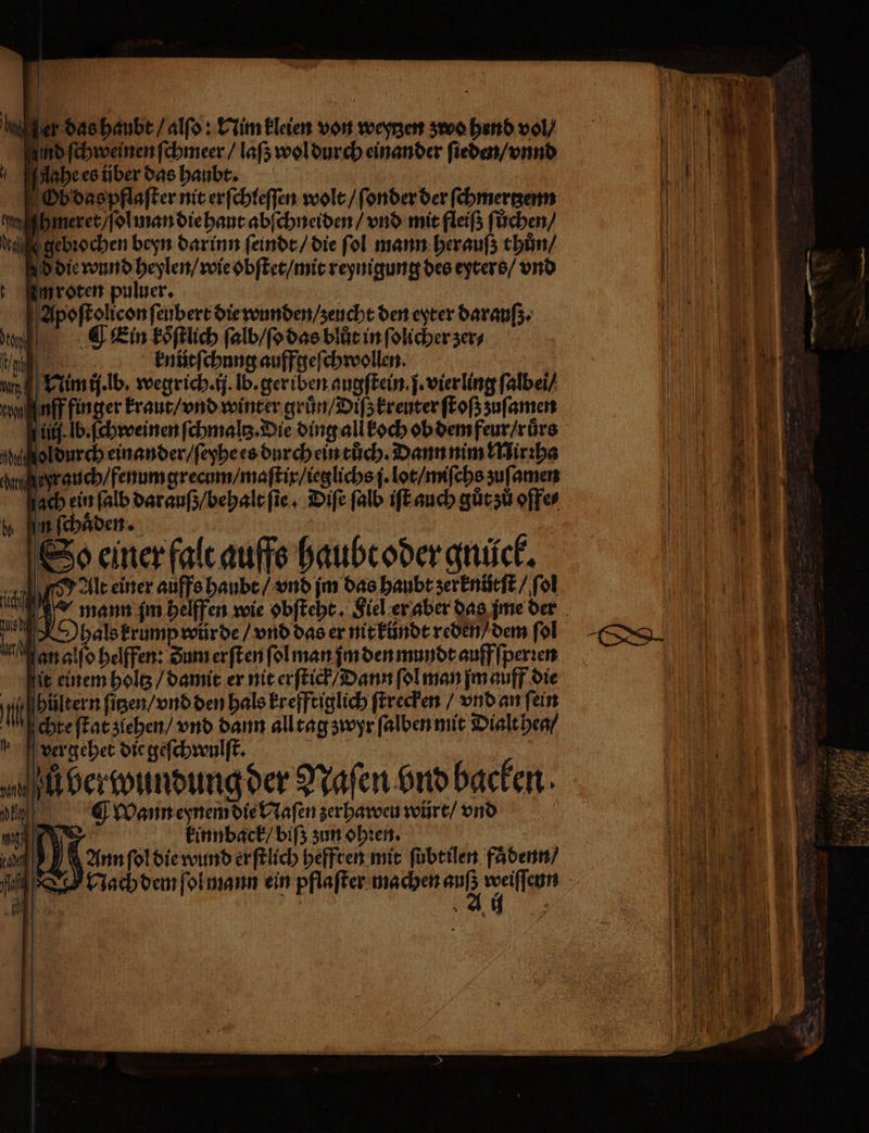 aher das haubt / alſo: Nim kleien von weyrzen zwo hend vol nd ſchweinen ſchmeer / laß; wol durch einander ſieden / vnnd Aahe es über das haubbt. Gbdaspflaſter nit erſchleſſen wolt / ſonder der ſchmertzenn cyaagh meret / ſol man die haut abſchneiden / vnd mit fleiß ſůchen / deal 0 gebꝛochen beyn darinn ſeindt / die fol mann herauſz thun / 8 die wund heylen / wie obſtet / mit reynigung des eyters / vnd iim roten puluer. a Apoſtolicon ſeubert die wunden / zeucht den eyter darauſz. N IE .d Ein Eöflich ſalb / ſo das blůt in ſolicher zer⸗ U knütſchung auffgeſchwollen. 15 u Nim jj. lb. wegrich.ij. lb. ger iben augſtein. j. vier ling ſalbei / cuil uff finger kraut / vnd winter gruͤn / Diſz kreuter ſtoß zuſamen u lb. ſchweinen ſchmaltz. Die ding all koch ob dem feur / ruͤrs hugol durch einander / ſeyhe es durch ein tůch. Dann nim Miriha or eyr auch / fenum grecum / maſtix / ieglichs j. lot / miſchs zuſamen ach ein ſalb darauß / behalt ſie. Diſe ſalb iſt auch gůt zů offe⸗ n ſchuͤden. . So einer falt auffs haubt oder gnück. Alt einer auffs haubt / vnd jm das haubt zerknütſt / fol * vergehet die geſchwulſt. | | wh ber wundung der Naſen bnd backen. ¶ wann eynem die Naſen zerhaweu würt / vnd kinnback / biſz zun ohꝛen. Ann ſol die wund erſtlich heffren mit ſubtilen faͤdenn / Mach dem ſol mann ein pflaſter machen auf 4 . ne ne — — — Fe =