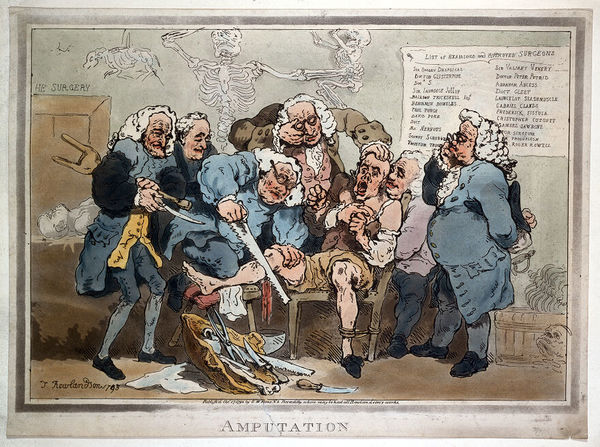 M0011783: Reproduction of an aquatint by T. Rowlandson with lettering "Amputation" underneath, 1793