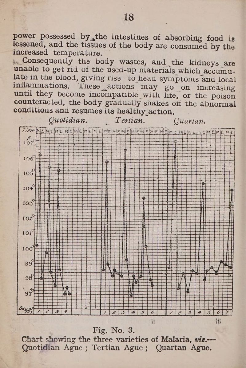 &amp; , or the poison y the it the abnormal ys are food is up materials which accumu- ~~ =f to head symptoms and local ues of the body are consumed b perature. Quarian. S may go on increasin Dle with lite 18 he body gradualiy shakes o y wastes, and the kidne Lerivan. used- , lving Lise - Yathe intestines of absorbin , and the tiss hese action resumes its healthy action. ». Consequently the bod unable to get rid of the late in the piood inflammations, until they become incompau counteracted, t Quotidian. conditions and power possessed b increased tem lessened advasartr HIT ani Ginn ETE Bea meee rH SUTASAAAREALA co Coote COCO Hees H BEGEEREGERAGHY SUUERUREEEAL rr H ae maa STURDSEUIATEN lalate ee ee TTT FUSUSORGUORS RR ORANSIGN = | TAT. CO PSR RINT it Ciesvcpc IMjE mie Moe a Pe oan on OO ae aay SES awe fe ams bai Kel a be ii 3 ti Quartan Ague. Ile IMiEb, Anepeonesm A bal lmale fe heen aanee a jeaena i geacusceesnseee0e8 Ba =H eH &amp; H H i 1H : yy HE rg = a ee GSR00RSGEnaiseenseasaccssa =. )RUSORGRD PUUSSUBRUSEAORSDRGRORERERARI HEH | Serr arteritit a eee Serene AVGRGGHERIGRAEGAE Teta Fig, No. 3. Chart showing the three varieties of Malaria, viz.— le fle lee tele isl | eeees eer a BE [Pt] +} +—— : rE —— ee oS af i: 5 { + ne rH — ee: Ee mle ery Seece het ~ 4 t+ Z = Sritar MSIRSIe tg i rw ty ar rt Baaessucesenacssesss 5x JUUSORRREERS, 5 COPS PTE iaceneaeaeens R eS RRS Se IA tay Be SO t S| ° Qo (2) ° ° Dp D aD = tes ~ ~ 7 x Quotidian Ague ; Tertian Ague ;
