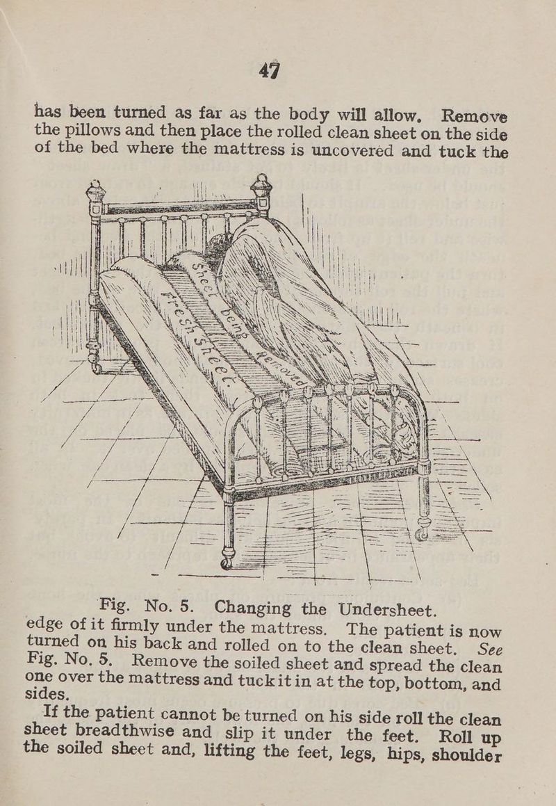 has been turned as far as the body will allow, Remove the pillows and then place the rolled clean sheet on the side of the bed where the mattress is uncoveréd and tuck the ‘|; nae ny WW. : \ { Fig. No. 5. Changing the Undersheet. edge of it firmly under the mattress. The patient is now turned on his back and rolled on to the clean sheet. See Fig. No. 5. Remove the soiled sheet and spread the clean one over the mattress and tuckitin at the top, bottom, and sides, If the patient cannot be turned on his side roll the clean sheet breadthwise and slip it under the feet. Roll up the soiled sheet and, lifting the feet, legs, hips, shoulder