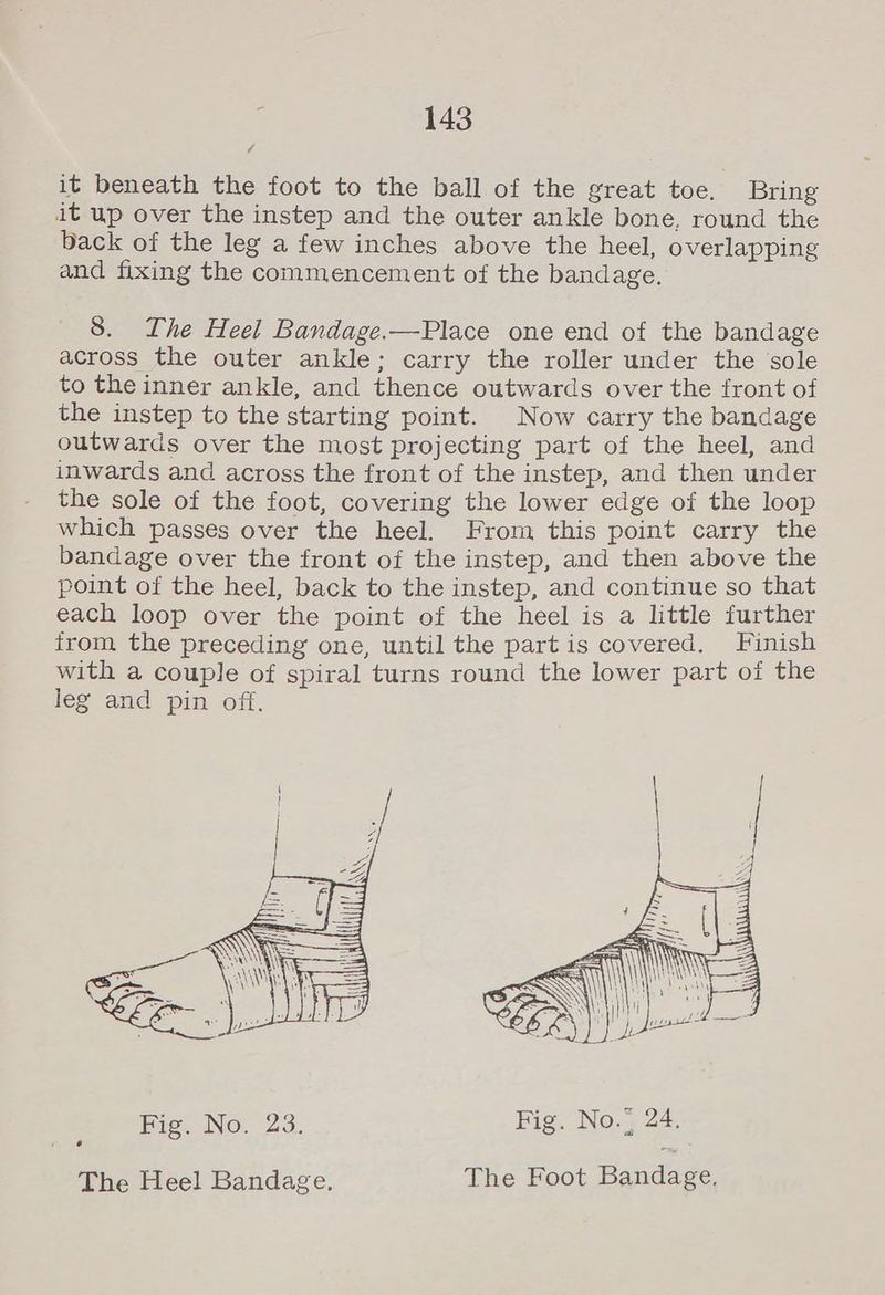 it beneath the foot to the ball of the great toe. Bring it up over the instep and the outer ankle bone, round the back of the leg a few inches above the heel, overlapping and fixing the commencement of the bandage. 8. The Heel Bandage.—Place one end of the bandage across the outer ankle; carry the roller under the sole to the inner ankle, and thence outwards over the front of the instep to the starting point. Now carry the bandage outwards over the most projecting part of the heel, and inwards and across the front of the instep, and then under the sole of the foot, covering the lower edge of the loop which passes over the heel. From this point carry the bandage over the front of the instep, and then above the point of the heel, back to the instep, and continue so that each loop over the point of the heel is a little further from the preceding one, until the part is covered. Finish with a couple of spiral turns round the lower part of the leg and pin off. Fig. No. 23. Fig. No.” 24, The Heel Bandage, The Foot Bandage.