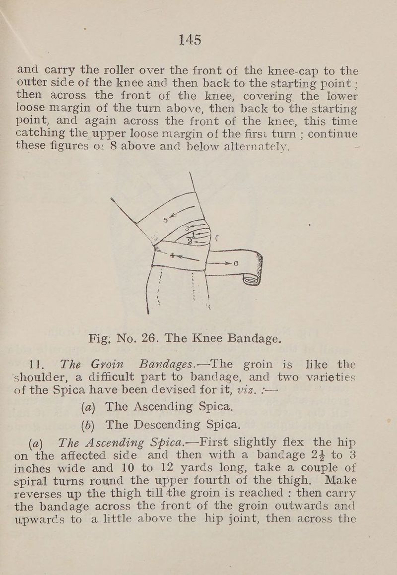 and carry the roller over the front of the knee-cap to the outer side of the knee and then back to the starting point ; then across the front of the knee, covering the lower loose margin of the turn above, then back to the starting point, and again across the front of the knee, this time catching the upper loose margin of the firsi turn ; continue these figures o: 8 above and below alternately. = Fig: No. 26. The Knee Bandage. 11. The Groin Bandages.—The groin is like the shoulder, a difficult part to bandage, and two varieties of the Spica have been devised for it, viz. :-— (a) The Ascending Spica. (6) The Descending Spica, (a) The Ascending Spica.—First slightly flex the hip on the affected side and then with a bandage 24 to 3 inches wide and 10 to 12 yards long, take a couple of spiral turns round the upper fourth of the thigh. Make reverses up the thigh till the groin is reached : then carry the bandage across the front of the groin outwards and upwarcs to a little above the hip joint, then across the