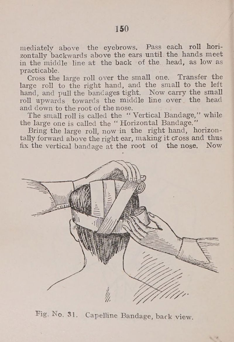 mediately above the eyebrows. Pass each roll hori- zontally backwards above the ears until. the hands meet in the middle line at the back of the head, as low as practicable. Cross the large roll over the small one. Transfer the large roll to the right hand, and the small to the left hand, and pull the bandages tight. Now carry the small roll upwards towards the middle line over. the head and down to the root of the nose. The small roll is called the ‘‘ Vertical Bandage,” while the large one is called the ‘‘ Horizontal Bandage.” Bring the large roll, now:in the right hand, horizon- tally forward above the right ear, making it cfoss and thus fix the vertical bandage at the root of the nose. Now