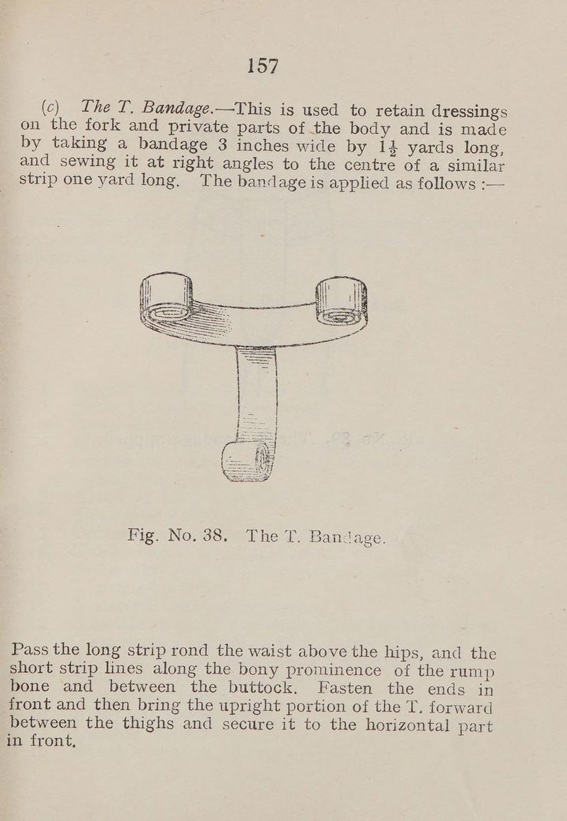 (c) Lhe T, Bandage.—This is used to retain dressings on the fork and private parts of the body and is made by taking a bandage 3 inches wide by 14 yards long, and sewing it at right angles to the centre of a similar strip one yard long. The bandage is applied as follows :— Fig. No. 38. The T. Bandage. Pass the long strip rond the waist above the hips, and the short strip lines along the bony prominence of the rump bone and between the buttock. Fasten the ends in front and then bring the upright portion of the T. forward between the thighs and secure it to the horizontal part in front,