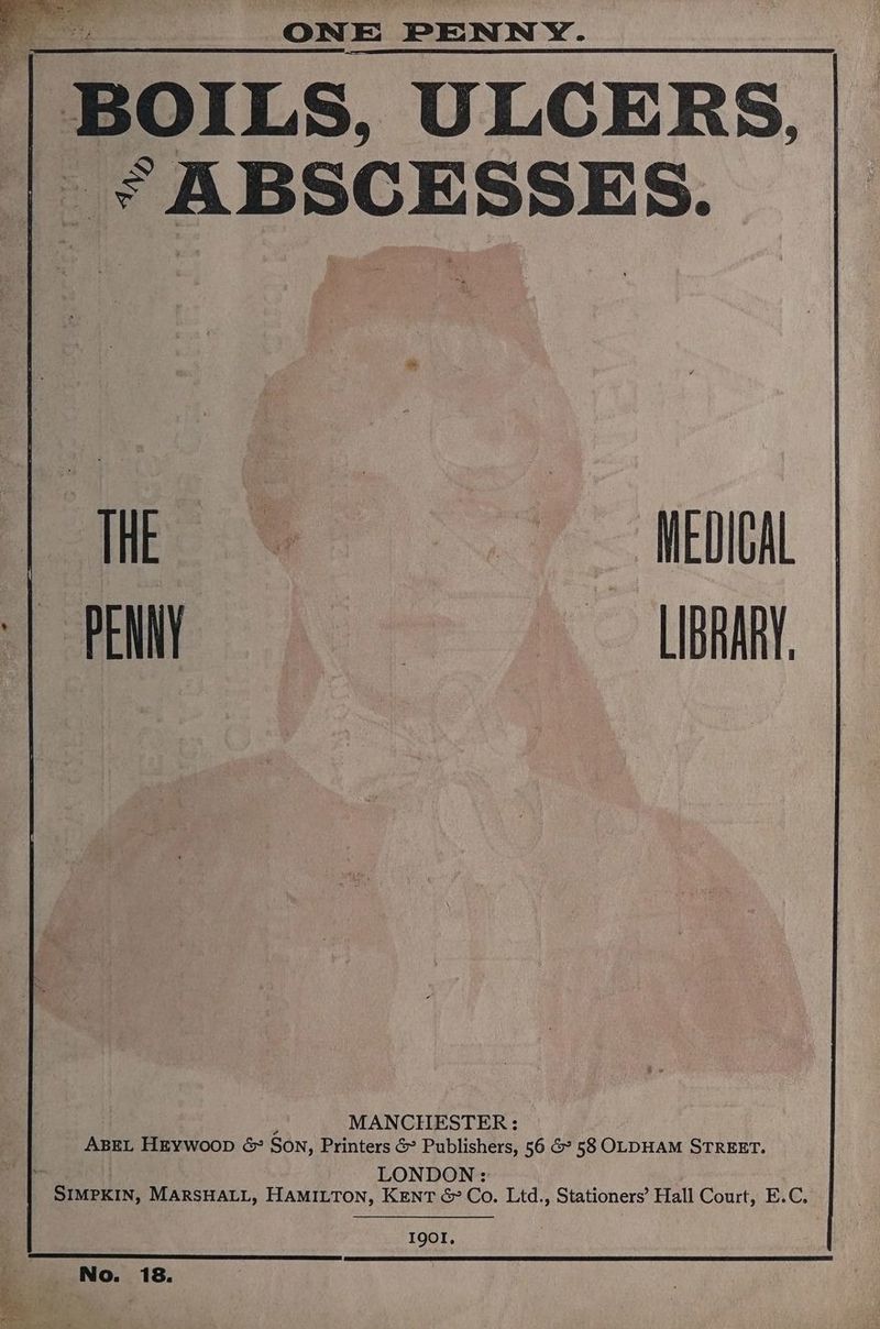 ONE PENNY. | BOILS, ULCERS, * ABSCESSES. mo ate fay LIBRE i MANCHIESTER: ABEL HEywoop &amp; Son, Printers &amp; Publishers, 56 &amp; 58 OLDHAM STREET. ‘ LONDON: Ronee it MARSHALL, HAMILTON, KENT &amp; Co. Ltd., Stationers’ Hall Court, E.C. I9OI. No. 18.