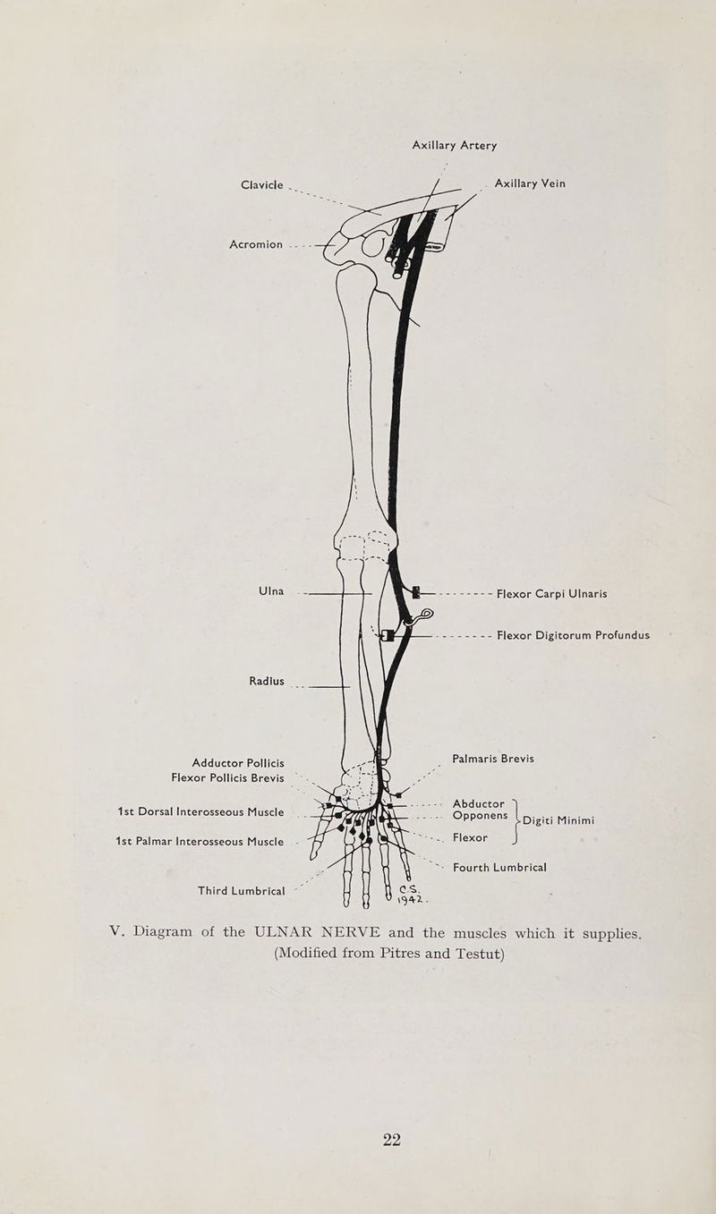 Axillary Artery Clavicle - Axillary Vein Acromion -- - - Ulna.-= Loy ene Flexor Carpi UlInaris sSecees 5 Flexor Digitorum Profundus Radius __ Adductor Pollicis Palmaris Brevis Flexor Pollicis Brevis > erate Abductor ist Dorsal Interosseous Muscle _.--. Opponens Digiti Minimi 1st Palmar Interosseous Muscle > ~. Flexor ~ ~ Fourth Lumbrical Third Lumbrical V. Diagram of the ULNAR NERVE and the muscles which it supplies. (Modified from Pitres and Testut)
