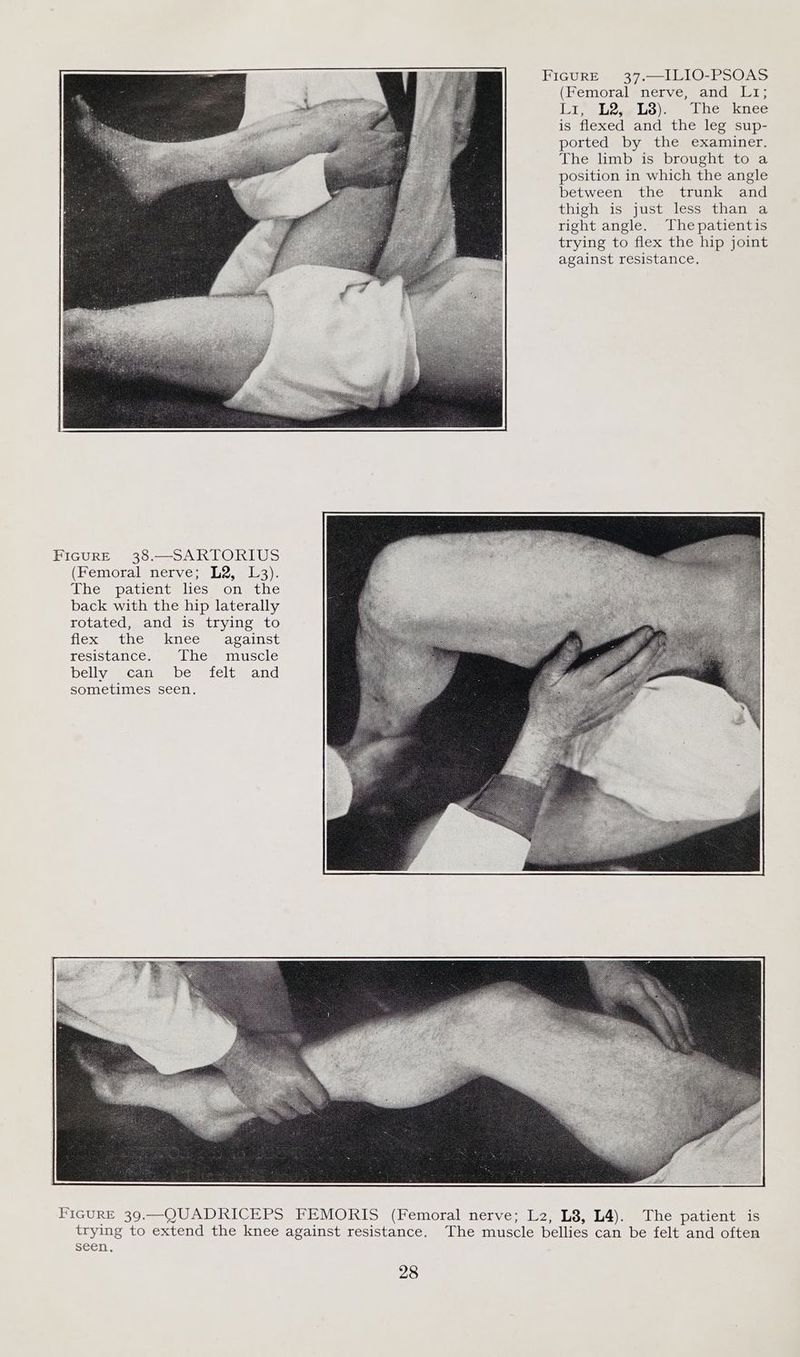 FIGURE 37.—ILIO-PSOAS (Femoral *nerve; and. Li; Lr, L23;¢L38), The knee is flexed and the leg sup- ported by the examiner. The limb is brought to a position in which the angle between the trunk and thigh is just less than a right angle. Thepatientis trying to flex the hip joint against resistance. FIGURE 38.—SARTORIUS (Femoralenerye-s 2-13). hes paticntaliess onthe back with the hip laterally rotated, and is trying to flex the knee against resistance. Lhes muscle bellyae canes Demeiclimeand sometimes seen.