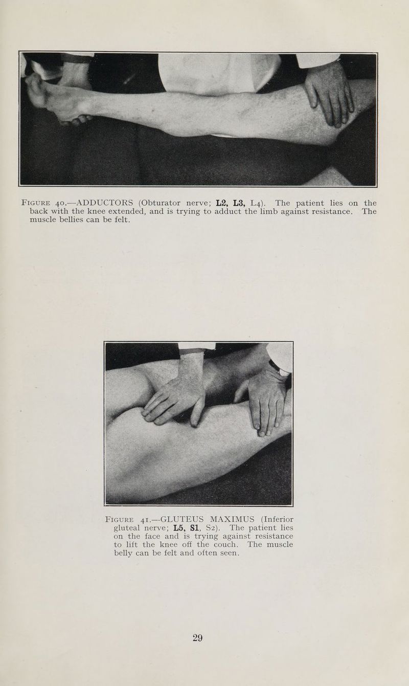 BIGuURE 40.—-ADDUCIOKS (Obturator nerve; L2; L3, 4). The patient lies. on back with the knee extended, and is trying to adduct the limb against resistance. muscle bellies can be felt. FIGURE 41.—-GLUTEUS MAXIMUS (Inferior gluteal nerve; LS, S1, Sz). The patient hes on the face and is trying against resistance CO, lit the knee off the couch. The muscle belly can be felt and often seen. 29 the The