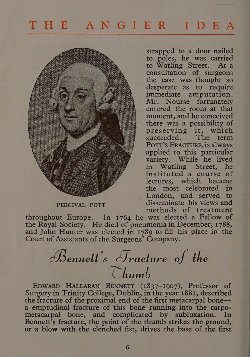 TH EA N Gol te i 4b Beene strapped to a door nailed to poles, he was carried to Watling Street. Ata consultation of surgeons the case was thought so desperate as to require immediate amputation. Mr. Nourse fortunately entered the room at that moment, and he conceived there was a possibility of preserving it, which succeeded. The term PorTT’s FRACTURE, is always applied to this particular variety. While he lived in Watling Street, he instituted a course of lectures, which became the most celebrated in London, and served to disseminate his views and methods of treatment throughout Europe. In 1764 he was elected a Fellow of the Royal Society. He died of pneumonia in December, 1788, and John Hunter was elected in 1789 to fill his place in the Court of Assistants of the Surgeons’ Company. Seapets Sracture a the Chimb EDWARD HALLARAN BENNETT (1837-1907), Professor of Surgery in Trinity College, Dublin, in the year 1881, described the fracture of the proximal end of the first metacarpal bone— a emptudinal fracture of this bone running into the carpo- metacarpal bone, and complicated by subluxation. In Bennett’s fracture, the point of the thumb strikes the ground, or a blow with the clenched fist, drives the base of the first