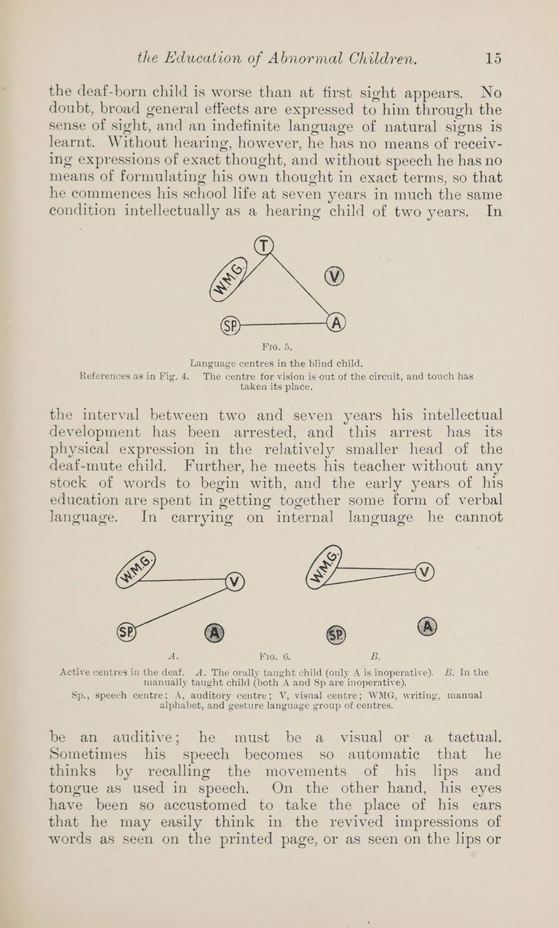 the deaf-born child is worse than at first sight appears. No doubt, broad general effects are expressed to him through the sense of sight, and an indefinite language of natural signs 1S learnt. Without hearing, however, he has no means of receiv- ing expressions of exact thought, and without speech he has no means of formulating his own thought in exact terms, so that he commences his school life at seven years in much the same condition intellectually as a hearing child of two years. In Language centres in the blind child. References as in Fig. 4. The centre for vision is out of the circuit, and touch has taken its place. the interval between two and seven years his intellectual development has been arrested, and this arrest has its physical expression in the relatively smaller head of the deaf-mute child. Further, he meets his teacher without any stock of words to begin with, and the early years of his education are spent in getting together some form of verbal Janguage. In carrying on internal language he cannot Ae Fie. 6. B. Active centres in the deaf. A. The orally taught child (only A is inoperative). 6. In the manually taught child (both A and Sp are inoperative). Sp., speech centre; A, auditory centre; V, visual centre; WMG, writing, manual alphabet, and gesture language group of centres. be an auditive; he must be a visual or a_ tactual. Sometimes his speech becomes so automatic that he thinks by recalling the movements of his lps and tongue as used in speech. On the other hand, his eyes have been so accustomed to take the place of his ears that he may easily think in the revived impressions of words as seen on the printed page, or as seen on the lips or