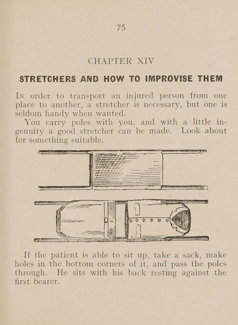 ris: CHAPTER X1V STRETCHERS AND HOW TO IMPROVISE THEM In order to transport an injured person from. one place to another, a stretcher is necessary, but one is seldom handy when wanted. You carry poles with you, and with a little in- genuity a good stretcher can be made. Look about for something suitable. If the patient is able-to ‘sit wp, take a sack, make holes in the bottom corners of it, and pass the poles through. He sits with his back resting against the first bearer.
