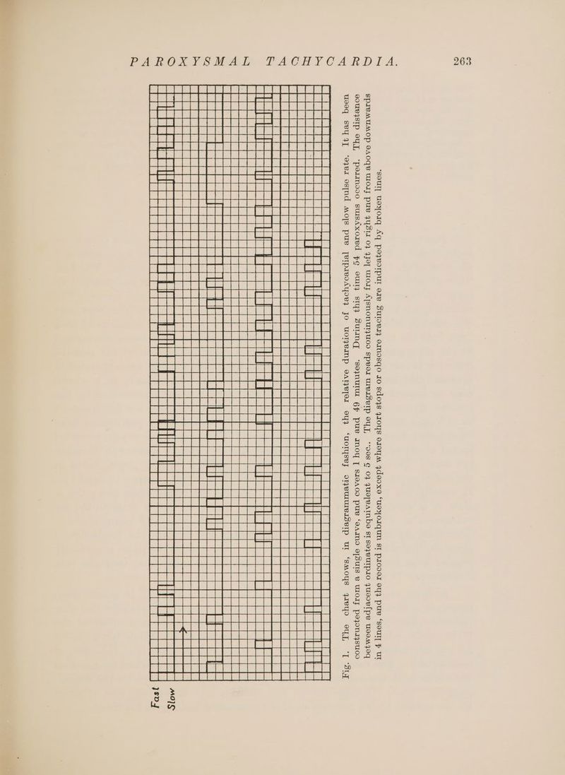. 263 PAROCAYSHAL TACHYCARDIA. eouBysIp Oy], “pormmooo0 surisAxored Fo owl sty? SuLNG