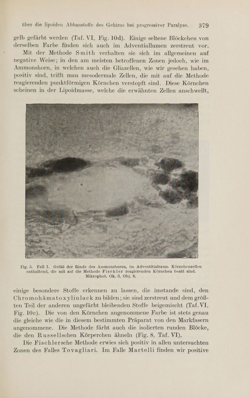 gelb gefärbt werden (Taf. VI, Fig. 10d). Einige seltene Blöckchen von derselben Farbe finden sich auch im Adventiallumen zerstreut vor. Mit der Methode Smith verhalten sie sich im allgemeinen auf negative Weise; in den am meisten betroffenen Zonen jedoch, wie im Ammonshorn, in welchen auch die Gliazellen, wie wir gesehen haben, positiv sind, trifft man mesodermale Zellen, die mit auf die Methode reagierenden punktförmigen Körnchen verstopft sind. Diese Körnchen scheinen in der Lipoidmasse, welche die erwähnten Zellen anschwellt, Fig. 5. Fall I. Gefäß der Rinde des Ammonshorns, im Adventitialraum Körnchenzellen enthaltend, die mit auf die Methode Fischler reagierenden Körnchen besät sind. Mikrophot. Ok. 3, Obj. 8. einige besondere Stoffe erkennen zu lassen, die imstande sind, den Chromohämatoxylinlack zu bilden; sie sind zerstreut und dem größ- ten Teil der anderen ungefärbt bleibenden Stoffe beigemischt (Taf. VI, Fig. 10c). Die von den Körnchen angenommene Farbe ist stets genau die gleiche wie die in diesem bestimmten Präparat von den Markfasern angenommene. Die Methode färbt auch die isolierten runden Blöcke, die den Russellschen Körperchen ähneln (Fig. 8, Taf. VI). Die Fischlersche Methode erwies sich positiv in allen untersuchten Zonen des Falles Tovagliari. Im Falle Martelli finden wir positive