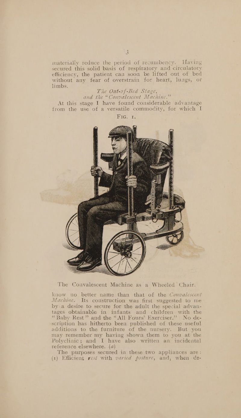 + materially reduce the period of recumbency. Having secured this solid basis of respiratory and circulatory efficiency, the patient can soon be lifted out of bed without any fear of overstrain for heart, lungs, or limbs. T he Out-of -Be ad S71ALE, and the “Convalescent ALachine.” At this stage I have found considerable advantage from the use of a versatile commodity, for which I The Convalescent Machine as a Wheeled Chair. know no better name than that of the Convalescent Machine. Its construction was first suggested to me by a desire to secure for the adult the special advan- tages obtainable in infants and children with the “Baby Rest”? and the “All Fours’ Exerciser.”” No de- scription has hitherto been published of these useful additions to the furniture of the nursery. But you may remember my having shown them to you at the Polyclinic; and I have also written an incidental reference elsewhere. (a) The purposes secured in these two appliances are: