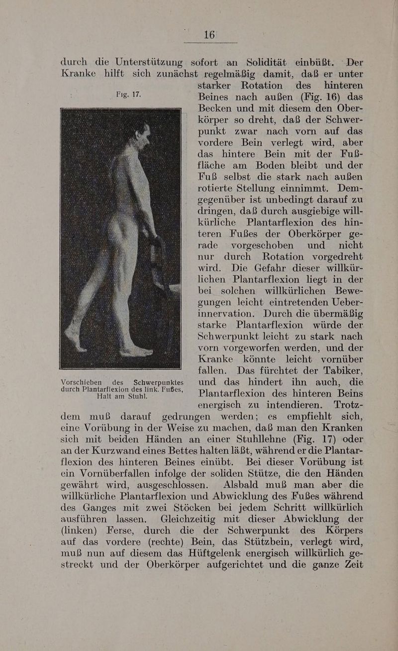durch die Unterstützung sofort an Solidität einbüßt. “Der Kranke hilft sich zunächst regelmäßig damit, daß er unter starker Rotation des hinteren Beines nach außen (Fig. 16) das Becken und mit diesem den Ober- körper so dreht, daß der Schwer- punkt zwar nach vorn auf das vordere Bein verlegt wird, aber das hintere Bein mit der Fuß- fläche am Boden bleibt und der Fuß selbst die stark nach außen rotierte Stellung einnimmt. Dem- segenüber ist unbedingt darauf zu dringen, daß durch ausgiebige will- kürliche Plantarflexion des hin- teren Fußes der Oberkörper ge- rade vorgeschoben und nicht nur durch Rotation vorgedreht wird. Die Gefahr dieser willkür- lichen Plantarflexion liegt in der bei solchen willkürlichen Bewe- gungen leicht eintretenden Ueber- innervation. Durch die übermäßig starke Plantarflexion würde der Schwerpunkt leicht zu stark nach vorn vorgeworfen werden, und der Kranke könnte leicht vornüber fallen. Das fürchtet der Tabiker, Vorschieben des Schwerpunkes und das hindert ihn auch, die durch Plantarflexion des link. Fußes, Pjantarflexion des hinteren Beins energisch zu intendieren. Trotz- dem muß darauf gedrungen werden; es empfiehlt sich, eine Vorübung in der Weise zu machen, daß man den Kranken sich mit beiden Händen an einer Stuhllehne (Fig. 17) oder an der Kurzwand eines Bettes halten läßt, während er die Plantar- flexion des hinteren Beines einübt. Bei dieser Vorübung ist ein Vornüberfallen infolge der soliden Stütze, die den Händen gewährt wird, ausgeschlossen. Alsbald muß man aber die willkürliche Plantarflexion und Abwicklung des Fußes während des Ganges mit zwei Stöcken bei jedem Schritt willkürlich ausführen lassen. Gleichzeitig mit dieser Abwicklung der (linken) Ferse, durch die der Schwerpunkt des Körpers auf das vordere (rechte) Bein, das Stützbein, verlegt wird, muß nun auf diesem das Hüftgelenk energisch willkürlich ge- streckt und der Oberkörper aufgerichtet und die ganze Zeit