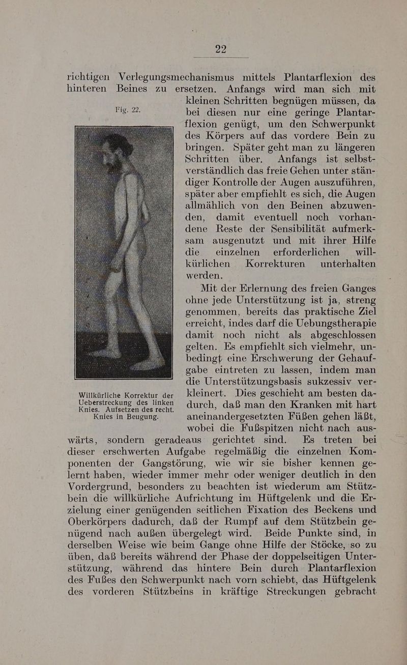 richtigen Verlegungsmechanismus mittels Plantarflexion des hinteren Beines zu ersetzen. Anfangs wird man sich mit kleinen Schritten begnügen müssen, da bei diesen nur eine geringe Plantar- flexion genügt, um den Schwerpunkt des Körpers auf das vordere Bein zu bringen. Später geht man zu längeren Schritten über. Anfangs ist selbst- verständlich das freie Gehen unter stän- diger Kontrolle der Augen auszuführen, später aber empfiehlt es sich, die Augen allmählich von den Beinen abzuwen- den, damit eventuell noch vorhan- dene Reste der Sensibilität aufmerk- sam ausgenutzt und mit ihrer Hilfe die einzelnen erforderlichen will- kürlichen Korrekturen unterhalten werden. Mit der Erlernung des freien Ganges ohne jede Unterstützung ist ja, streng genommen, bereits das praktische Ziel erreicht, indes darf die Uebungstherapie damit noch nicht als abgeschlossen gelten. Es empfiehlt sich vielmehr, un- bedingt eine Erschwerung der Gehauf- gabe eintreten zu lassen, indem man die Unterstützungsbasis sukzessiv ver- Willkürliche Korrektur der Kleinert. Dies geschieht am besten da- ee durch, daß man den Kranken mit hart Knies in Beugung. aneinandergesetzten Füßen gehen läßt, wobei die Fußspitzen nicht nach aus- wärts, sondern geradeaus gerichtet sind. Es treten bei dieser erschwerten Aufgabe regelmäßig die einzelnen Kom- ponenten der Gangstörung, wie wir sie bisher kennen ge- lernt haben, wieder immer mehr oder weniger deutlich in den Vordergrund, besonders zu beachten ist wiederum am Stütz- bein die willkürliche Aufrichtung im Hüftgelenk und die Er- zielung einer genügenden seitlichen Fixation des Beckens und Oberkörpers dadurch, daß der Rumpf auf dem Stützbein ge- nügend nach außen übergelegt wird. Beide Punkte sind, in derselben Weise wie beim Gange ohne Hilfe der Stöcke, so zu üben, daß bereits während der Phase der doppelseitigen Unter- stützung, während das hintere Bein durch Plantarflexion des Fußes den Schwerpunkt nach vorn schiebt, das Hüftgelenk des vorderen Stützbeins in kräftige Streckungen gebracht