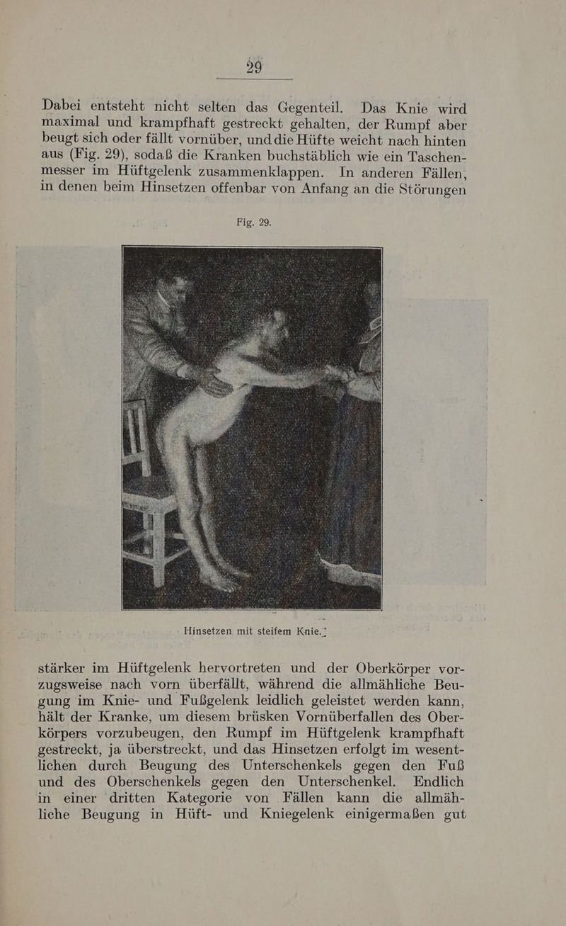 Dabei entsteht nicht selten das Gegenteil. Das Knie wird maximal und krampfhaft gestreckt gehalten, der Rumpf aber beugt sich oder fällt vornüber, und die Hüfte weicht nach hinten aus (Fig. 29), sodaß die Kranken buchstäblich wie ein Taschen- messer im Hüftgelenk zusammenklappen. In anderen Fällen, in denen beim Hinsetzen offenbar von Anfang an die Störungen Fig. 29. stärker im Hüftgelenk hervortreten und der Oberkörper vor- zugsweise nach vorn überfällt, während die allmähliche Beu- gung im Knie- und Fußgelenk leidlich geleistet werden kann, hält der Kranke, um diesem brüsken Vornüberfallen des Ober- körpers vorzubeugen, den Rumpf im Hüftgelenk krampfhaft gestreckt, ja überstreckt, und das Hinsetzen erfolgt im wesent- lichen durch Beugung des Unterschenkels gegen den Fuß und des ÖOberschenkels gegen den Unterschenkel. Endlich in einer dritten Kategorie von Fällen kann die allmäh- liche Beugung in Hüft- und Kniegelenk einigermaßen gut