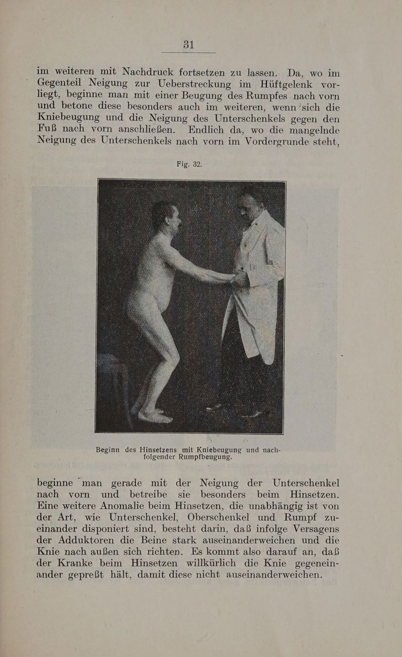 öl im weiteren mit Nachdruck fortsetzen zu lassen. Da, wo im Gegenteil Neigung zur Ueberstreckung im Hüftgelenk vor- liegt, beginne man mit einer Beugung des Rumpfes nach vorn und betone diese besonders auch im weiteren, wenn ’'sich die Kniebeugung und die Neigung des Unterschenkels gegen den Fuß nach vorn anschließen. Endlich da, wo die mangelnde Neigung des Unterschenkels nach vorn im Vordergrunde steht, Fig. 32. beginne man gerade mit der Neigung der Unterschenkel nach vorn und betreibe sie besonders beim Hinsetzen. Eine weitere Anomalie beim Hinsetzen, die unabhängig ist von der Art, wie Unterschenkel, Oberschenkel und Rumpf zu- einander disponiert sind, besteht darin, daß infolge Versagens der Adduktoren die Beine stark auseinanderweichen und die Knie nach außen sich richten. Es kommt also darauf an, daß der Kranke beim Hinsetzen willkürlich die Knie gegenein- ander gepreßt hält, damit diese nicht auseinanderweichen.