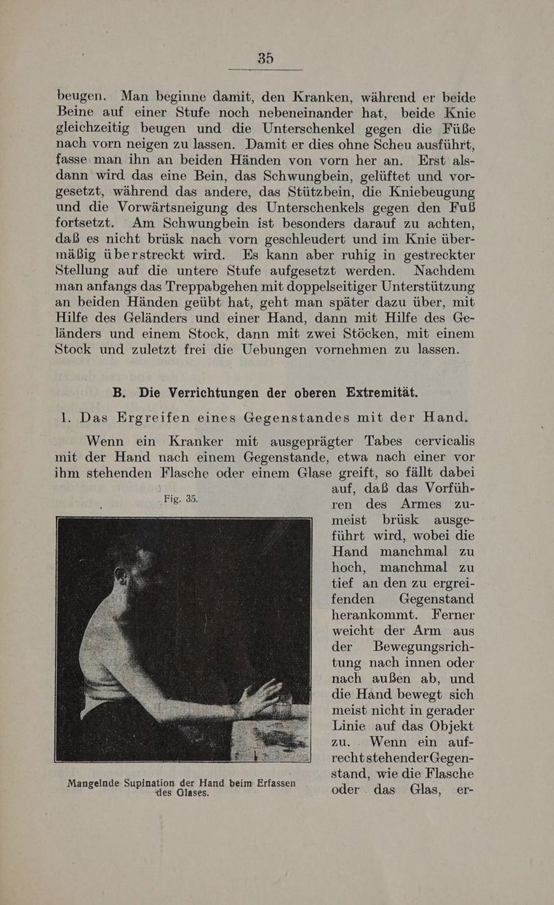 beugen. Man beginne damit, den Kranken, während er beide Beine auf einer Stufe noch nebeneinander hat, beide Knie gleichzeitig beugen und die Unterschenkel gegen die Füße nach vorn neigen zu lassen. Damit er dies ohne Scheu ausführt, fasseman ihn an beiden Händen von vorn her an. Erst als- dann wird das eine Bein, das Schwungbein, gelüftet und vor- gesetzt, während das andere, das Stützbein, die Kniebeugung und die Vorwärtsneigung des Unterschenkels gegen den Fuß fortsetzt. Am Schwungbein ist besonders darauf zu achten, daß es nicht brüsk nach vorn geschleudert und im Knie über- mäßig überstreckt wird. Es kann aber ruhig in gestreckter Stellung auf die untere Stufe aufgesetzt werden. Nachdem man anfangs das Treppabgehen mit doppelseitiger Unterstützung an beiden Händen geübt hat, geht man später dazu über, mit Hilfe des Geländers und einer Hand, dann mit Hilfe des Ge- länders und einem Stock, dann mit zwei Stöcken, mit einem Stock und zuletzt frei die Uebungen vornehmen zu lassen. B. Die Verrichtungen der oberen Extremität. 1. Das Ergreifen eines Gegenstandes mit der Hand. Wenn ein Kranker mit ausgeprägter Tabes cervicalis mit der Hand nach einem Gegenstande, etwa nach einer vor ihm stehenden Flasche oder einem Glase greift, so fällt dabei auf, daß das Vorfüh- ren des Armes zu- meist brüsk ausge- führt wird, wobei die Hand manchmal zu hoch, manchmal zu tief an den zu ergrei- fenden Gegenstand herankommt. Ferner weicht der Arm aus der Bewegungsrich- tung nach innen oder nach außen ab, und die Hand bewegt sich meist nicht in gerader Linie auf das Objekt zu. . Wenn ein auf- rechtstehenderGegen- er eltla Scninaticn der Hank Heime Fıf stand, wie die Flasche nde nation der Hand be Ri es Glases. BR a oder . das Glas, er-