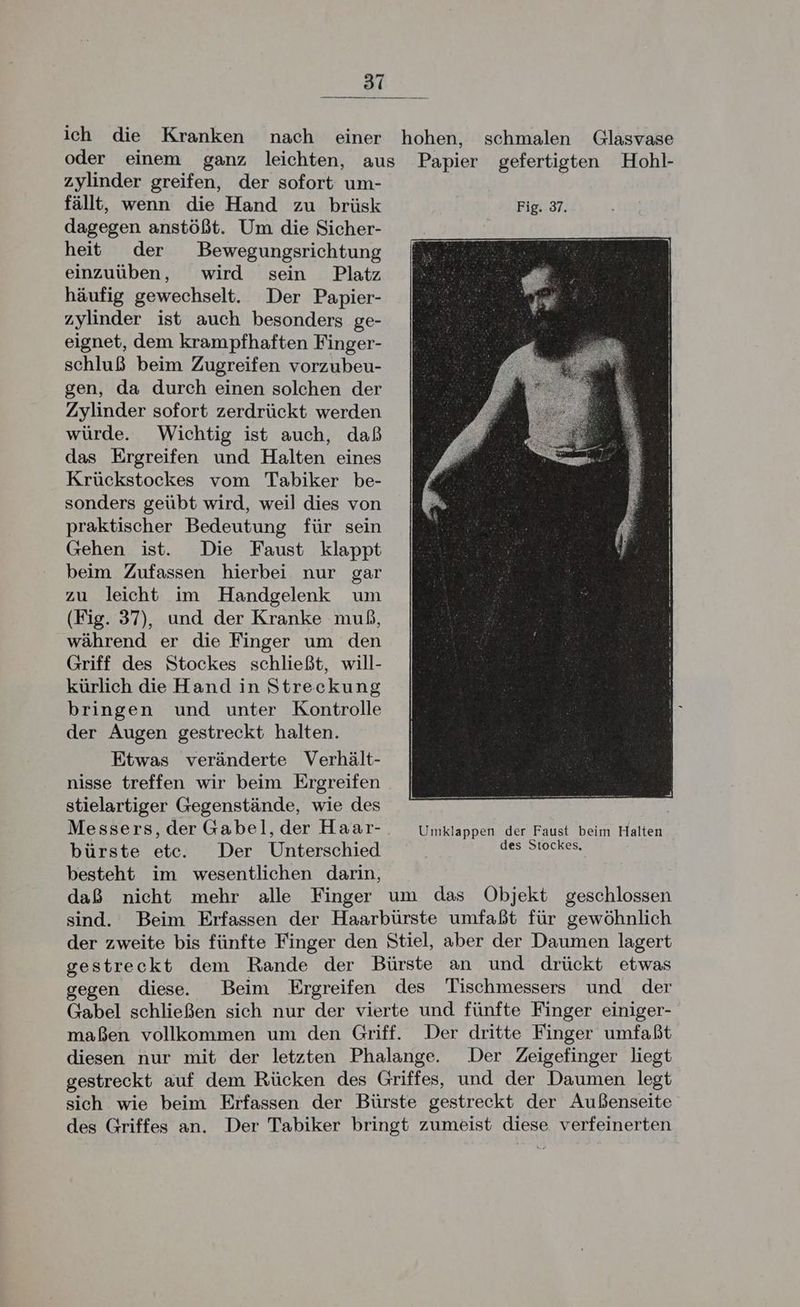ich die Kranken nach einer hohen, schmalen Glasvase oder einem ganz leichten, aus Papier gefertigten Hohl- zylinder greifen, der sofort um- fällt, wenn die Hand zu brüsk Fig. 37. dagegen anstößt. Um die Sicher- heit der Bewegungsrichtung einzuüben, wird sein Platz häufig gewechselt. Der Papier- zylinder ist auch besonders ge- eignet, dem krampfhaften Finger- schluß beim Zugreifen vorzubeu- gen, da durch einen solchen der Zylinder sofort zerdrückt werden würde. Wichtig ist auch, daß das Ergreifen und Halten eines Krückstockes vom Tabiker be- sonders geübt wird, weil dies von praktischer Bedeutung für sein Gehen ist. Die Faust klappt beim Zufassen hierbei nur gar zu leicht im Handgelenk um (Fig. 37), und der Kranke muß, während er die Finger um den Griff des Stockes schließt, will- kürlich die Hand in Streckung bringen und unter Kontrolle der Augen gestreckt halten. Etwas veränderte Verhält- nisse treffen wir beim Ergreifen stielartiger Gegenstände, wie des Messers, der Gabel, der Haar- Umklappen der Faust beim Halten bürste etc. Der Unterschied es ca besteht im wesentlichen darin, daß nicht mehr alle Finger um das Objekt geschlossen sind. Beim Erfassen der Haarbürste umfaßt für gewöhnlich der zweite bis fünfte Finger den Stiel, aber der Daumen lagert gestreckt dem Rande der Bürste an und drückt etwas gegen diese. Beim Ergreifen des Tischmessers und der Gabel schließen sich nur der vierte und fünfte Finger einiger- maßen vollkommen um den Griff. Der dritte Finger umfaßt diesen nur mit der letzten Phalange. Der Zeigefinger liegt gestreckt auf dem Rücken des Griffes, und der Daumen legt sich wie beim Erfassen der Bürste gestreckt der Außenseite des Griffes an. Der Tabiker bringt zumeist diese verfeinerten
