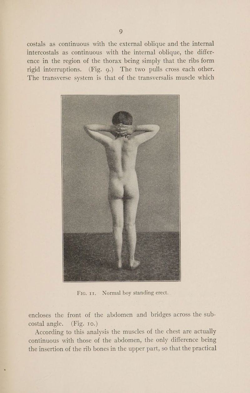 costals as continuous with the external oblique and the internal intercostals as continuous with the internal oblique, the differ- ence in the region of the thorax being simply that the ribs form rigid interruptions. (Fig. 9.) The two pulls cross each other. The transverse system is that of the transversalis muscle which encloses the front of the abdomen and bridges across the sub- costal angle. (Fig. 10.) According to this analysis the muscles of the chest are actually continuous with those of the abdomen, the only difference being the insertion of the rib bones in the upper part, so that the practical