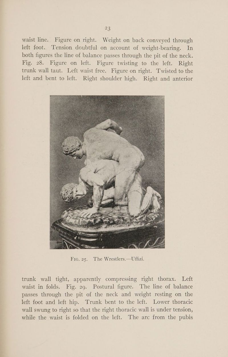 waist line. Figure on right. Weight on back conveyed through left foot. Tension. dcubtful on account of weight-bearing. In both figures the line of balance passes through the pit of the neck. Fig. 28. Figure on left. Figure twisting to the left. Right trunk wall taut. Left waist free. Figure on right. Twisted to the left and bent to left. Right shoulder high. Right and anterior trunk wall tight, apparently compressing right thorax. Left waist in folds. Fig. 29. Postural figure. The line of balance passes through the pit of the neck and weight resting on the left foot and left hip. Trunk bent to the left. Lower thoracic wall swung to right so that the right thoracic wall is under tension, while the waist is folded on the left. The arc from the pubis