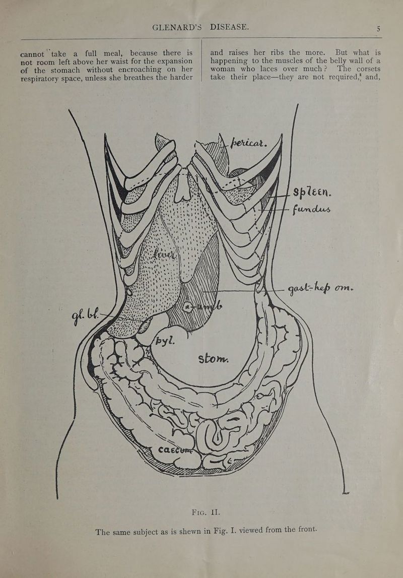 ut cannot take a full meal, because there is not room left above her waist for the expansion of the stomach without encroaching on her respiratory space, unless she breathes the harder and raises her ribs the more. But what is happening to the muscles of the belly wall of a woman who laces over much? ‘The corsets take their place—they are not required,’ and,