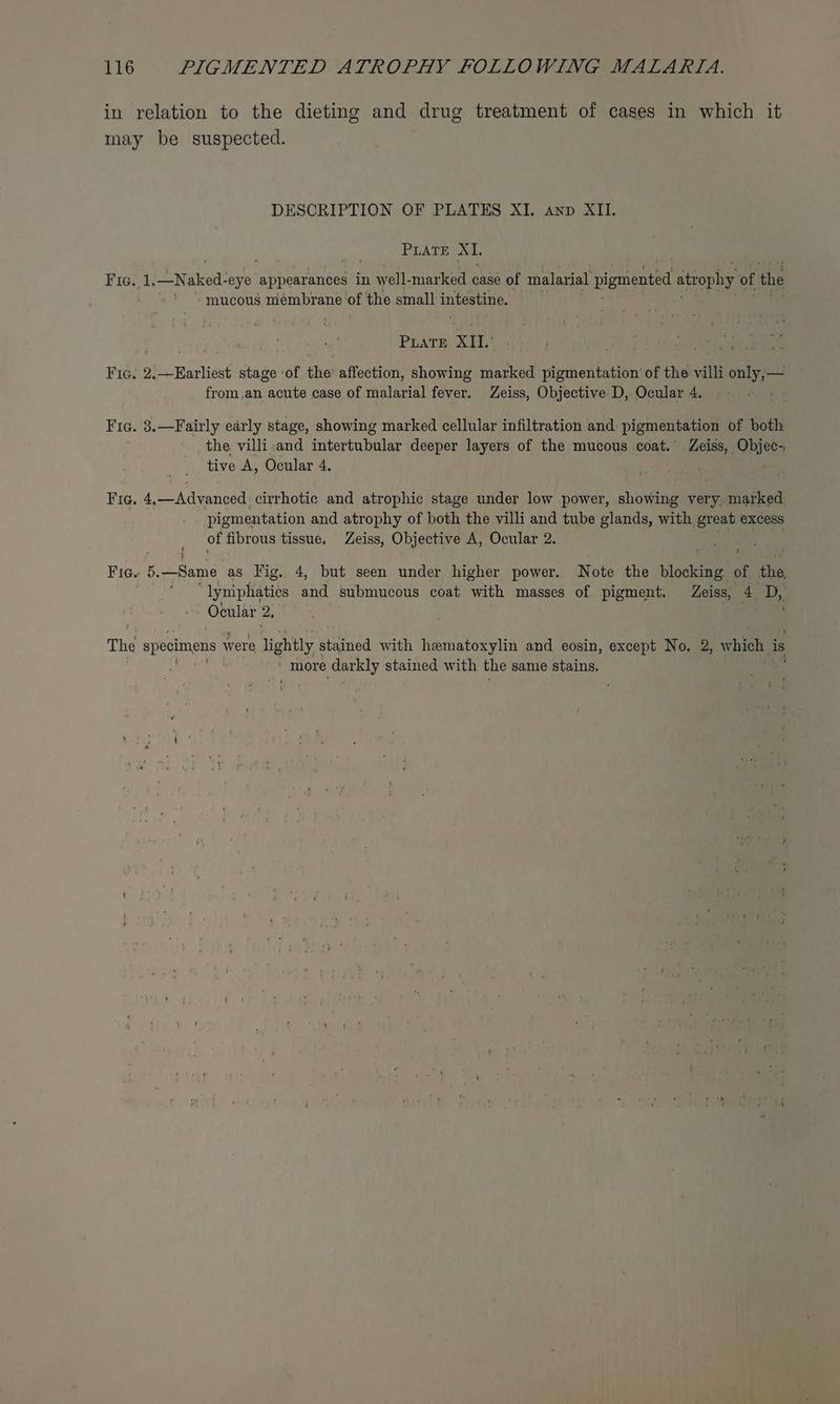 in relation to the dieting and drug treatment of cases in which it may be suspected. DESCRIPTION OF PLATES XI. anp XII. PLATE XI. Fic. 1. Naked: -eye appearances in well-marked case of malarial pigmented atrophy of the ~ mucous mémbrane of the small intestine. Phare XU Lak oo) 1 Se ee Fic. 2.—Earliest stage of the affection, showing marked pigmentation of the villi only,— from.an acute case of malarial fever. Zeiss, Objective D, Ocular 4. Fic. 3.—Fairly early stage, showing marked cellular infiltration and pigmentation of both the villi and intertubular deeper layers of the mucous coat.’ Zeiss, Objec-, tive A, Ocular 4. Fic. 4.—Advanced cirrhotic and atrophic stage under low power, showing very, marked pigmentation and atrophy of both the villi and tube glands, with great excess of fibrous tissue. Zeiss, Objective A, Ocular 2. Fig. beaane as Fig. 4, but seen under higher power. Note the blocking of the, lyniphatics oan submucous coat ath masses of pigment. Zeiss, 4 D, Ocular 2, The specimens were lightly aeiad with hematoxylin and eosin, except No. 2, which As more darkly stained with the same stains.