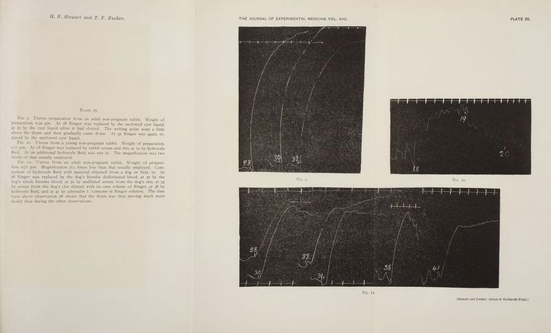 PLATE 25. Fic. 9. Uterus preparation from an adult non-pregnant rabbit. Weight of preparation, 0.30 gm. At 28 Ringer was replaced by the unclotted cyst liquid, at 30 by the cyst liquid after it had clotted. The writing point went a little above the drum and then gradually came down. At 32 Ringer was again re- placed by the unclotted cyst liquid. Fie. to. Uterus from a young non-pregnant rabbit. Weight of preparation, 0.17 gm. At 18 Ringer was replaced by rabbit serum and this at 10 by hydrocele fluid. At 20 additional hydrocele fluid was run in. The magnification was two thirds of that usually employed. Fic. 11. Uterus from an adult non-pregnant rabbit. Weight of prepara- tion, 0.71 gm. Magnification 2% times less than that usually employed. Com- parison of hydrocele fluid with material obtained from a dog on Sept. 10. At 28 Ringer was replaced by the dog’s hirudin defibrinated blood, at 30 by the dog’s whole hirudin blood, at 32 by undiluted serum from the dog’s clot, at 34 by serum from the dog’s clot diluted with its own volume of Ringer, at 38 by hydrocele fluid, and at 41 by adrenalin 1: 1,000,000 in Ringer solution. The time trace above observation 28 shows that the drum was then moving much more slowly than during the other observations. THE JOURNAL OF EXPERIMENTAL MEDICINE VOL. XVII. PLATE 25.