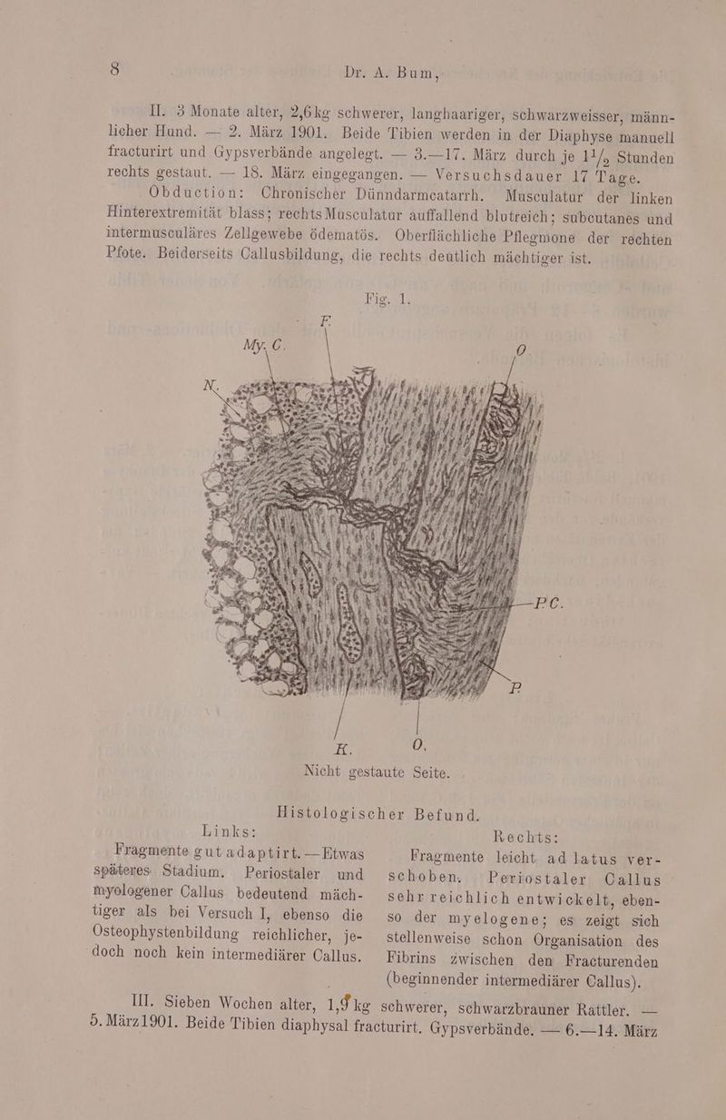 Il. 5 Monate alter, 2,6kg schwerer, langhaariger, schwarzweisser, männ- licher Hund. — 2. März 1901. Beide Tibien werden in der Diaphyse manuell fracturirt und Gypsverbände angelegt. — 3.—17. März durch je 11/, Stunden rechts gestaut. — 18. März eingegangen. — Versuchsdauer 17 Tage. ‚ Obduetion: Chronischer Dünndarmcatarrh. Museulatur der linken Hinterextremität blass; rechts Musculatur auffallend blutreich; subcutanes und intermusculäres Zellgewebe ödematös. Oberflächliche Pflegmone der rechten Pfote. Beiderseits Callusbildung, die rechts deutlich mächtiger ist. Histologischer Befund. Links: Fragmente gut adaptirt. — Etwas späteres Stadium. Periostaler und myologener Callus bedeutend mäch- tiger als bei Versuch I, ebenso die Osteophystenbildung reichlicher, je- doch noch kein intermediärer Callus. Rechts: Fragmente leicht ad latus ver- schoben. Periostaler sehr reichlich entwickelt, eben- so der myelogene; es zeigt sich stellenweise schon Organisation des Fibrins zwischen den Fracturenden (beginnender intermediärer Callus).