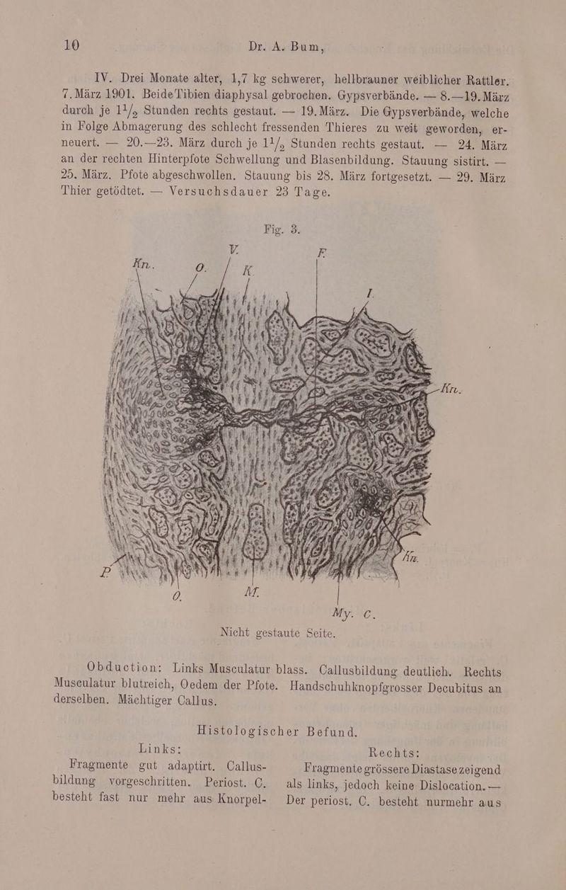 IV. Drei Monate alter, 1,7 kg schwerer, hellbrauner weiblicher Rattler. 7.März 1901. Beide’Tibien diaphysal gebrochen. Gypsverbände. — 8.—19. März durch je 11/, Stunden rechts gestaut. — 19. März. Die Gypsverbände, welche in Folge Abmagerung des schlecht fressenden Thieres zu weit geworden, er- neuert. — 20.—23. März durch je 11/, Stunden rechts gestaut. — 24. März an der rechten Hinterpfote Schwellung und Blasenbildung. Stauung sistirt. — 25. März. Pfote abgeschwollen. Stauung bis 28. März fortgesetzt. — 29. März Thier getödtet. — Versuchsdauer 23 Tage. Fig. 3. Obduction: Links Musculatur blass. Callusbildung deutlich. Rechts Museulatur blutreich, Oedem der Pfote. Handschuhknopfgrosser Decubitus an derselben. Mächtiger Callus. Histologischer Befund. Links: Rechts: Fragmente gut adaptirt. Callus- Fragmente grössere Diastase zeigend bildung vorgeschritten. Periost. C. als links, jedoch keine Dislocation. — besteht fast nur mehr aus Knorpel- Der periost. OÖ. besteht nurmehr aus