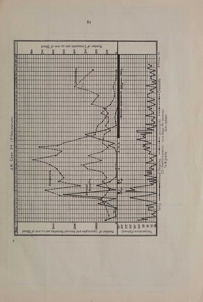 JK. Case 24. (P falciparum) Ae eee poojg jo ww nd vad sjuassau7) yo vaquiny fo} 1o) oO SEMELC Ee S LS et G | Qt S HORRRRRGRRRREE BOE CCC Te HRURRTULUEL ces SAIATAOTAAMAMONIMAMGEOHAVGECOWRIOSOUGGGHOHOEAG AKAMAI TU Es BUTT St A TTT PTT Te TT PCCP CE AULLECHAGGEEEEEEAA EE RGEOeTUMAY SAGA TET Pa tt AIAGUOHOUSNORUUANALGEMANGGANESALAHOCGON | SOHGRAHATOUE PUTT ae att St ARE EERE ECECCCCe EAM ECC MERE ERU REUSE REDROPERDERROURRER BEDS? AGRCQODS. GRRDERRREOEE = Sa ap eater te MT eee TTT pe eee esere AREER eee Pres Tt | sMUNENRE===c 10K BE = es BaBVGRHE3Un5= 21 SHVENTNGHTEDOS= over spleen coe @orse Leucocytes. 0-2 —--0e=(Crescents. ~ (x=x.Rays. For 20 mins) Soamin vgrains) to X grains @ee@Qee al Parasites (S =~ Seo ai ee a p a 7 CEU | ALLL LLL Ht Bae tt Hadas sail PHTHSGGGEELUEELEU GML OGGEOUUEEEEERTG300:/SUEELUUR a PTs LTT TT LTR POET ETT PPT ETE Oeil “Poojg jo Ww Nd uad sayiseuey jenxosy pug sayfiooona| jo uaquny | (uauuey) SRE [ Days.