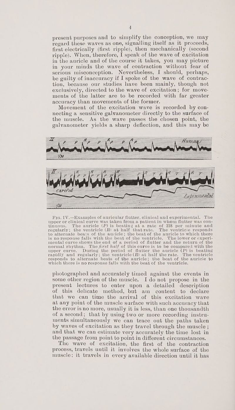present purposes and to simplify the conception, we may regard these waves as one, signalling itself as it proceeds, first electrically (first ripple), then mechanically (second ripple). When, therefore, I speak of the wave of excitation in the auricle and of the course it takes, you may picture in your minds the wave of contraction without fear of serious misconception. Nevertheless, I should, perhaps, be guilty of inaccuracy if I spoke of the wave of contrac- tion, because our studies have been mainly, though not exclusively, directed to the wave of excitation; for move- ments of the latter are to be recorded with far greater accuracy than movements of the former. Movement of the excitation wave is recorded by con- necting a sensitive galvanometer directly to the surface of the muscle. As the wave passes the chosen point, the galvanometer yields a sharp deflection, and this may be Fie. [1V.—Examples of auricular flutter, clinical and experimental. The upper or clinical curve was taken from a patient in whom flutter was con- tinuous. The auricle (P) is beating at a rate of 228 per minute and regularly; the ventricle (R) at half thatrate. The ventricle responds to alternate beats of the auricle; the beat of the auricle to which there is no response falls with the beat of the ventricle. The lower or experi- mental curve shows the end of a period of flutter and the return of the normal rhythm. The first half of this curve is to be compared with the upper curve. During the period of flutter the auricle (P) is beating rapidly and regularly; the ventricle (R) at half the rate. The ventricle responds to alternate beats of the auricle; the beat of the auricle to which there is no response falls with the beat of the ventricle. photographed and accurately timed against the events in some other region of the muscle. I do not propose in the present lectures to enter upon a detailed description of this delicate method, but am content to declare that we can time the arrival of this excitation wave at any point of the muscle surface with such accuracy that the error is no more, usually it is less, than one thousandth of a second; that by using two or more recording instru- ments simultaneously we can trace out the paths taken by waves of excitation as they travel through the muscle ; and that we can estimate very accurately the time lost in the passage from point to point in different circumstances. The wave of excitation, the first of the contraction process, travels until it involves the whole surface of the muscle; it travels in every available direction until it has