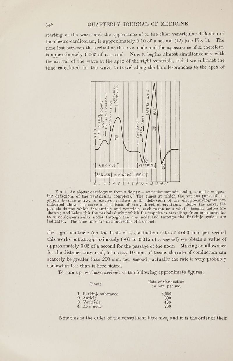 ~ starting of the wave and the appearance of R, the chief ventricular deflexion of the electro-cardiogram, is approximately 0-10 of a second (12) (see Fig. 1). The time lost between the arrival at the a.-v. node and the appearance of R, therefore, is approximately 0-065 of a second. Now R begins almost simultaneously with the arrival of the wave at the apex of the right ventricle, and if we subtract the time calculated for the wave to travel along the bundle-branches to the apex of AURICLE Rey al { | 1 Al | | $v 44 | Be | a lena es : | a 2= = We ais = < ee = 22 <o v Bs eel c lg eee, ona ee Gd reas] | ae aay | x e= = 5 oe, ] k el ene uy q ie (i (a fied | Go igs 2 | Bs OS Posy : Te) ware fi a 7 29 | Sel | IRI fete va <7 Ces <= | zk Ms ww | | > t a 4 \ 4 : | | tS AN-AVN. ay NODE CRN Iu PS SOR TUE RS OLS ' ’ _ Fie. 1. An electro-cardiogram from a dog (P = auricular summit, and Q, R, and S = open- ing deflexions of the ventricular complex). The times at which the various parts of the ~ muscle become active, or excited, relative to the deflexions of the electro-cardiogram are indicated above the curve on the basis of many direct observations. Below the curve, the periods during which the auricle and ventricle, each taken as a whole, become active are shown ; and below this the periods during which the impulse is travelling from sino-auricular to auriculo-ventricular nodes through the a.-v. node and through the Purkinje system are indicated. The time lines are in hundredths of a second. the right ventricle (on the basis of a conduction rate of 4,000 mm. per second this works out at approximately 0-01 to 0-015 of a second) we obtain a value of approximately 0-05 of a second for the passage of the node. Making an allowance for the distance traversed, let us say 10 mm. of tissue, the rate of conduction can scarcely be greater than 200 mm. per second; actually the rate is very probably somewhat less than is here stated. To sum up, we have arrived at the following approximate figures : Rate of Conduction Tissue. in mm. per sec. 1. Purkinje substance 4,000 2. Auricle 800 3. Ventricle 400 4, A.-v. node 200 Now this is the order of the constituent fibre size, and it is the order of their