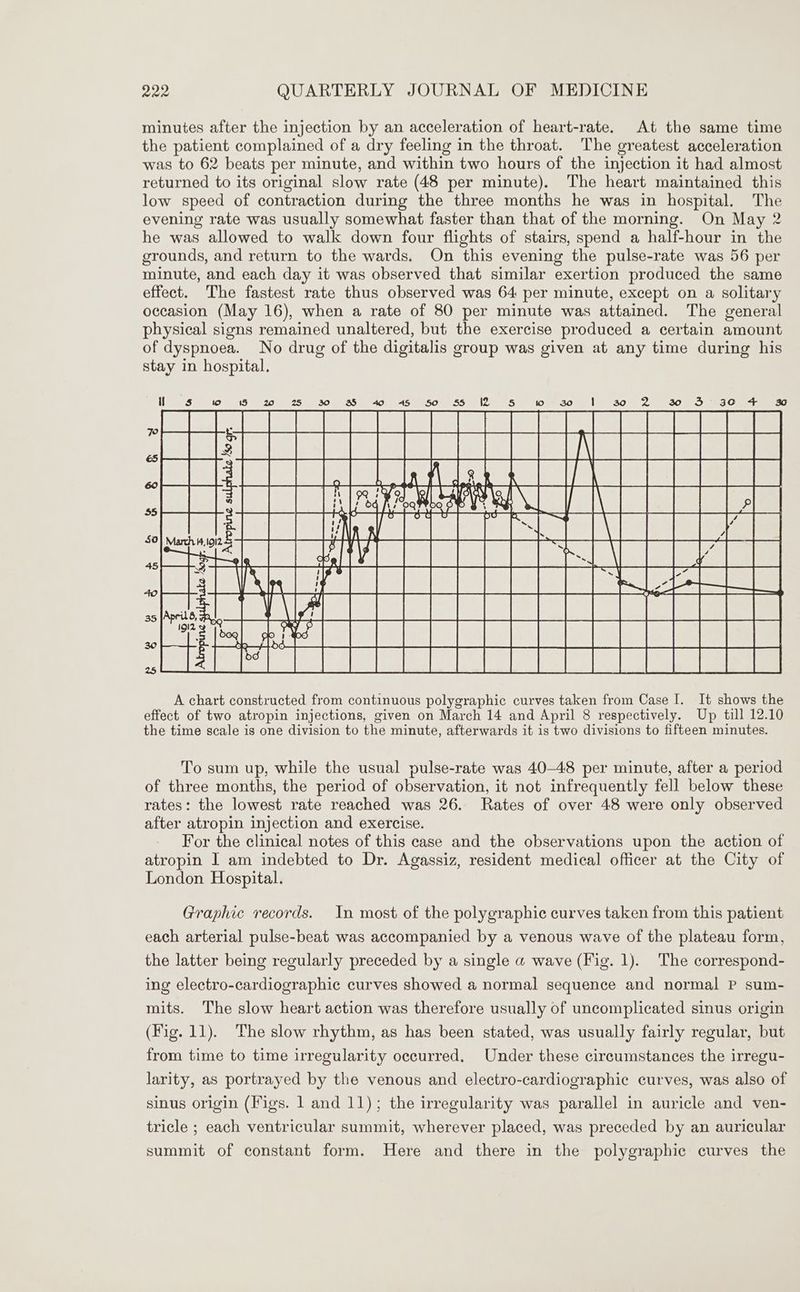 minutes after the injection by an acceleration of heart-rate. At the same time the patient complained of a dry feeling in the throat. The greatest acceleration was to 62 beats per minute, and within two hours of the injection it had almost returned to its original slow rate (48 per minute). The heart maintained this low speed of contraction during the three months he was in hospital. The evening rate was usually somewhat faster than that of the morning. On May 2 he was allowed to walk down four flights of stairs, spend a half-hour in the grounds, and return to the wards. On this evening the pulse-rate was 56 per minute, and each day it was observed that similar exertion produced the same effect. The fastest rate thus observed was 64 per minute, except on a solitary occasion (May 16), when a rate of 80 per minute was attained. The general physical signs remained unaltered, but the exercise produced a certain amount of dyspnoea. No drug of the digitalis group was given at any time during his stay in hospital. To sum up, while the usual pulse-rate was 40-48 per minute, after a period of three months, the period of observation, it not infrequently fell below these rates: the lowest rate reached was 26. Rates of over 48 were only observed after atropin injection and exercise. For the clinical notes of this case and the observations upon the action of atropin I am indebted to Dr. Agassiz, resident medical officer at the City of London Hospital. Graphic records. In most of the polygraphic curves taken from this patient each arterial pulse-beat was accompanied by a venous wave of the plateau form, the latter being regularly preceded by a single a wave (Fig. 1). The correspond- ing electro-cardiographic curves showed a normal sequence and normal P sum- mits. The slow heart action was therefore usually of uncomplicated sinus origin (Fig. 11). The slow rhythm, as has been stated, was usually fairly regular, but from time to time irregularity occurred, Under these circumstances the irregu- larity, as portrayed by the venous and electro-cardiographic curves, was also of sinus origin (Figs. 1 and 11); the irregularity was parallel in auricle and ven- tricle ; each ventricular summit, wherever placed, was preceded by an auricular summit of constant form. Here and there in the polygraphic curves the