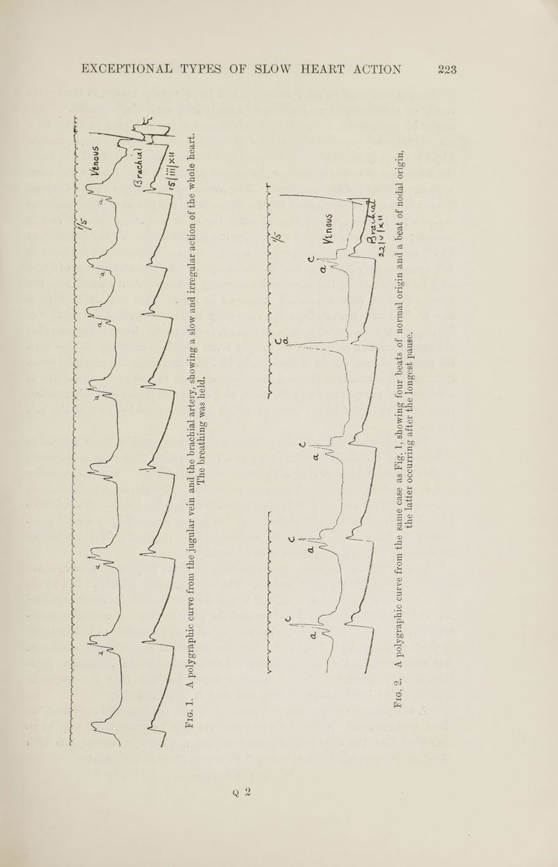 ‘asned 4sasUO] 94} 10}Jv SUTTINDO 199}k] OY ‘ULSTIO [VPOU Fo qvoq &amp; PUY ULSIIO TVULIOU JO S}]VEq INO} SUIMOYS ‘T “SLY SB asvo otULS oY} ory oAIND o1ydvrsdéjod WY ‘zg ‘NI wx] ales *plel[ SVM SUITZVeIq OT, ‘JIVOY SOYA OY} JO UOTJOV AV[NSOIIT pu MOTS V SULMOYS ‘ATO}AV [BIYOVIG oY} puv UTA IvpnSNl oy Woy oaIno orydeasAjod y ‘T ‘pI a yous 5) fey}