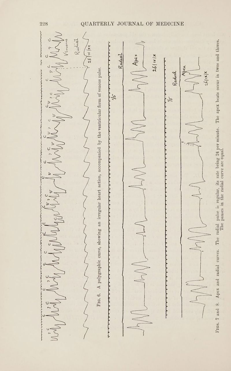 ‘Tenba ov 9AmMo [eIper oy} ur sasnvd ayy, ‘s0d1Y} PUB SOY UL Ind00 syvoq xodv ayy, ‘oynutm sod FZ Sutoq oyva sqrt ‘AvpNSoA st os—nd jetpet oy, ‘soamno [wiper puv xody ‘g pu ) ‘SDI, x} x1] 97 x{ x1 |9% ay Ny Wy yi Vp OM ostnd snowaa Jo UOJ AvpNITAyUeA OY} Aq potuvdurodoe ‘UOTJOR JAVA AV[NSeII1 UY Butmoys ‘oatno orydeisdjod wy ‘9 ‘NWT PP eek fe Ned eg ee es sg a PS,