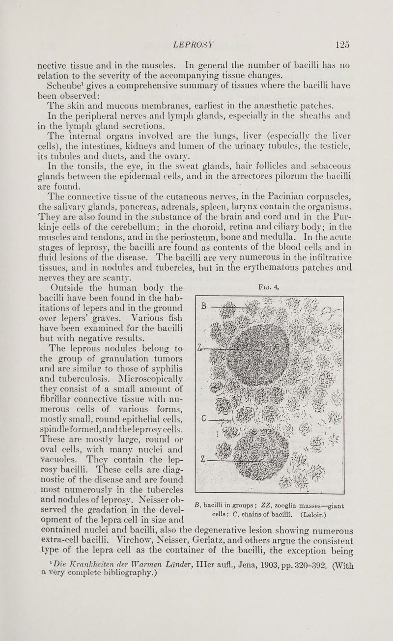 nective tissue and in the muscles. In general the number of bacilli has no relation to the severity of the accompanying tissue changes. Scheube! gives a comprehensive summary of tissues where the bacilli have been observed: The skin and mucous membranes, earliest in the aneesthetic patches. In the peripheral nerves and lymph glands, especially in the sheaths and in the lymph gland secretions. The internal organs involved are the lungs, liver (especially the liver cells), the intestines, kidneys and lumen of the urinary tubules, the testicle, its tubules and ducts, and the ovary. In the tonsils, the eye, in the sweat glands, hair follicles and sebaceous glands between the epidermal cells, and in the arrectores pilorum the bacilli are found. te ES The connective tissue of the cutaneous nerves, in the Pacinian corpuscles, the salivary glands, pancreas, adrenals, spleen, larynx contain the organisms. They are also found in the substance of the brain and cord and in the Pur- kinje cells of the cerebellum; in the choroid, retina and ciliary body; in the muscles and tendons, and in the periosteum, bone and medulla. In the acute stages of leprosy, the bacilli are found as contents of the blood cells and in fluid lesions of the disease. The bacilli are very numerous in the infiltrative tissues, and in nodules and tubercles, but in the erythematous patches and nerves they are scanty. Outside the human body the bacilli have been found in the hab- itations of lepers and in the ground over lepers’ graves. Various fish have been examined for the bacilli but with negative results. The leprous nodules belong to the group of granulation tumors and are similar to those of syphilis and tuberculosis. Microscopically they consist of a small amount of fibrillar connective tissue with nu- merous cells of various forms, mostly small, round epithelial cells, spindle formed, and the leprosy cells. These are mostly large, round or oval cells, with many nuclei and vacuoles. They contain the lep- rosy bacilli. These cells are diag- nostic of the disease and are found most numerously in the tubercles and nodules of leprosv. Neisser ob- & thant: SF served the gradation in the devel- 777 UPS: eee pec te ‘ ; cells; C, chains of bacilli. (Leloir.) opment of the lepra cell in size and contained nuclei and bacilli, also the degenerative lesion showing numerous extra-cell bacilli. Virchow, Neisser, Gerlatz, and others argue the consistent type of the lepra cell as the container of the bacilli, the exception being ‘Die Krankheiten der Warmen Lander, IIer aufl., Jena, 1903, pp. 320-392. (With a very complete bibliography.)