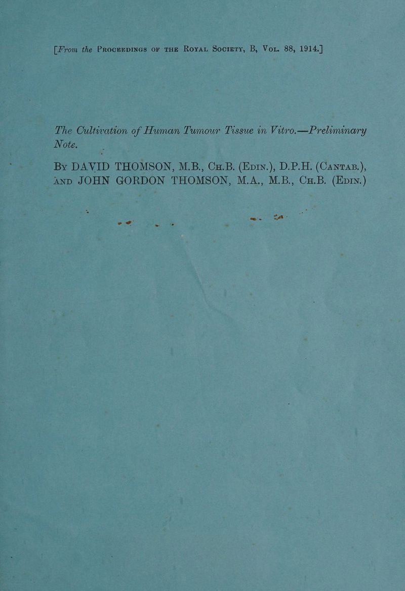 The Cultivation of Human Tumour Tissue in Vitro.—Prelimmnary Note. By DAVID THOMSON, M.B,, Cu.B. (Eprv.), D.P.H. (Canras,), anp JOHN GORDON THOMSON, M.A., M.B., Ca.B. (Epry.) = 5 2 = a:@%